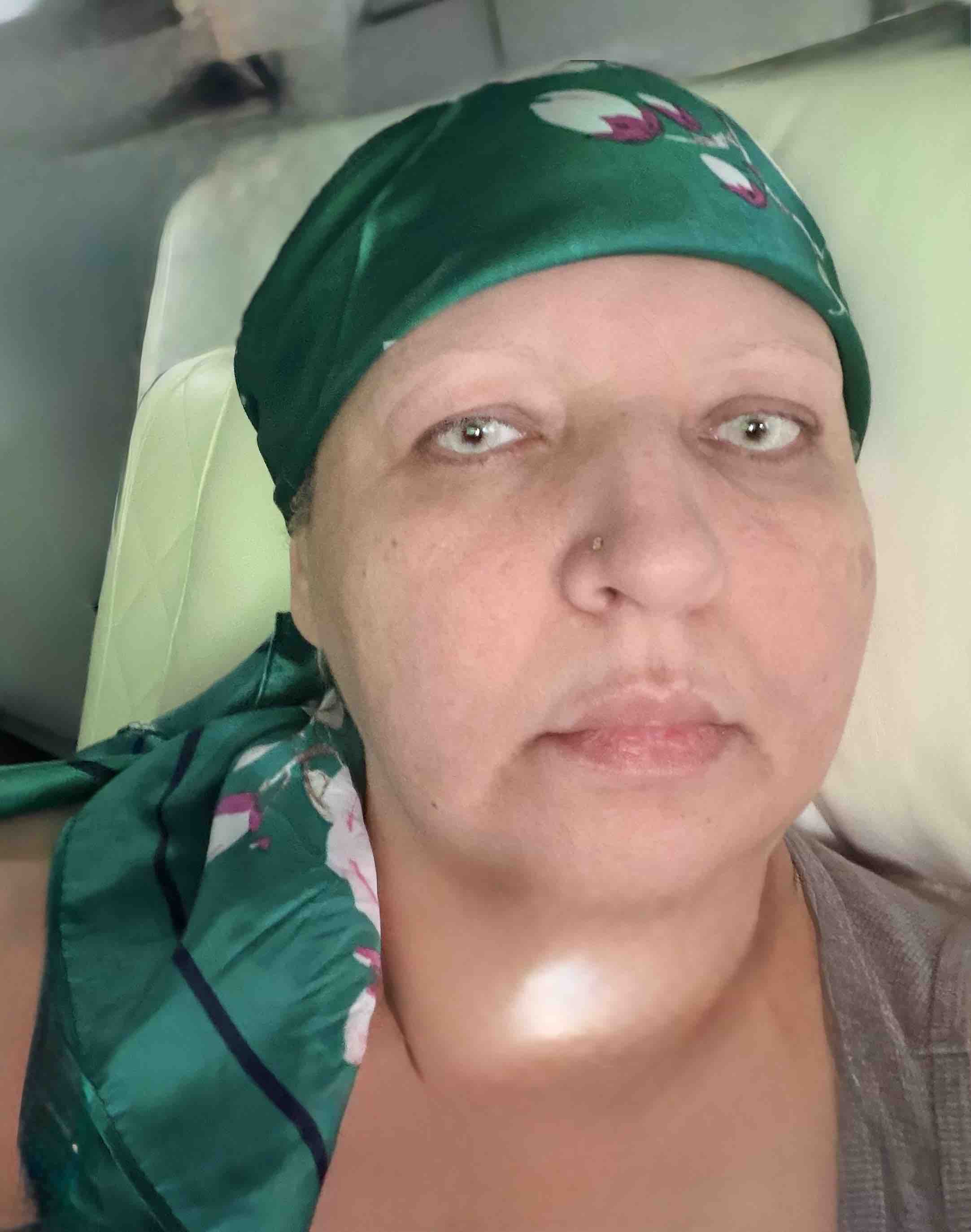 Help my family while I fight cancer campaign photo, 2 of 4