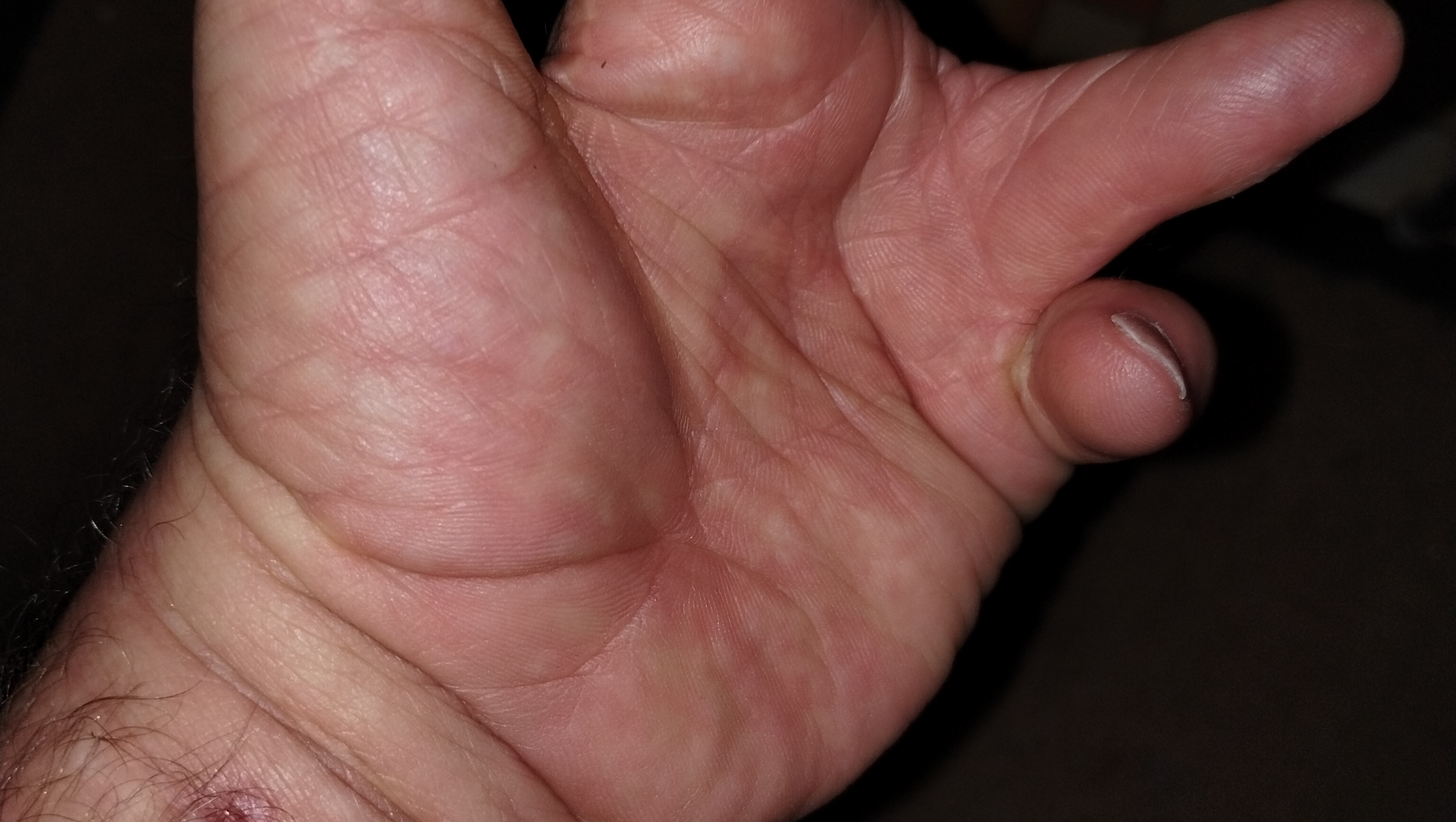 disabled carnt help others in need  photo