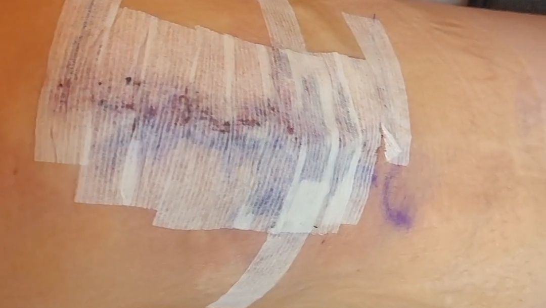 recaudar fondos photo