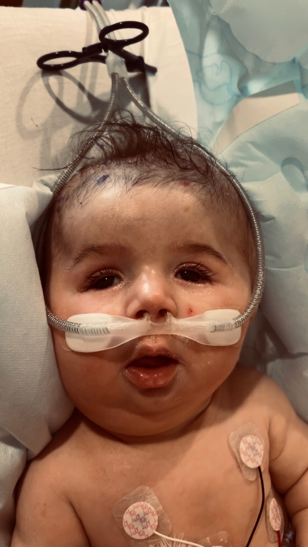 Help Us Through Our Son’s Medical Journey campaign photo, 6 of 7