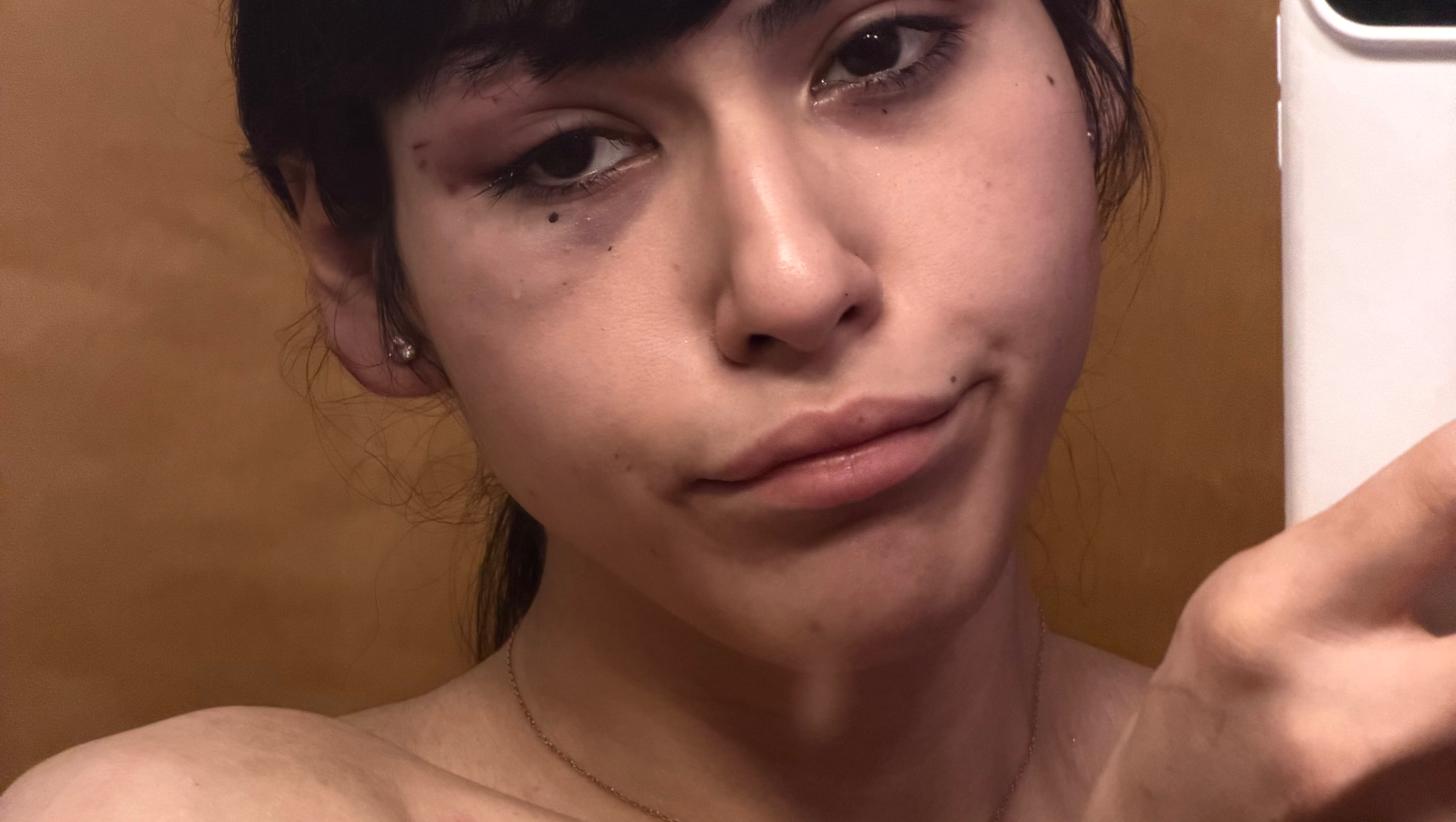 Support Lilith After Assault and Injury photo