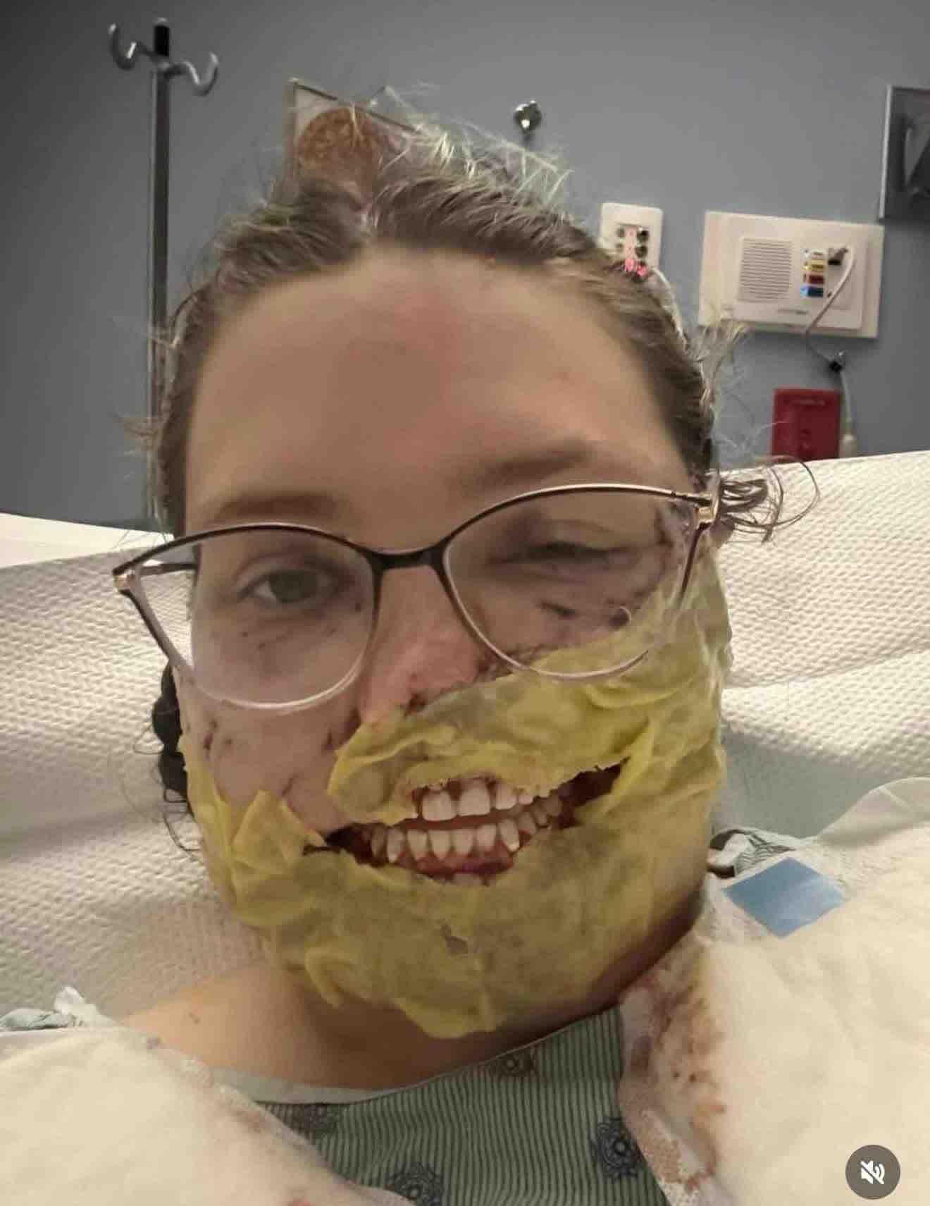 Help with nose transplant surgery campaign photo, 4 of 5