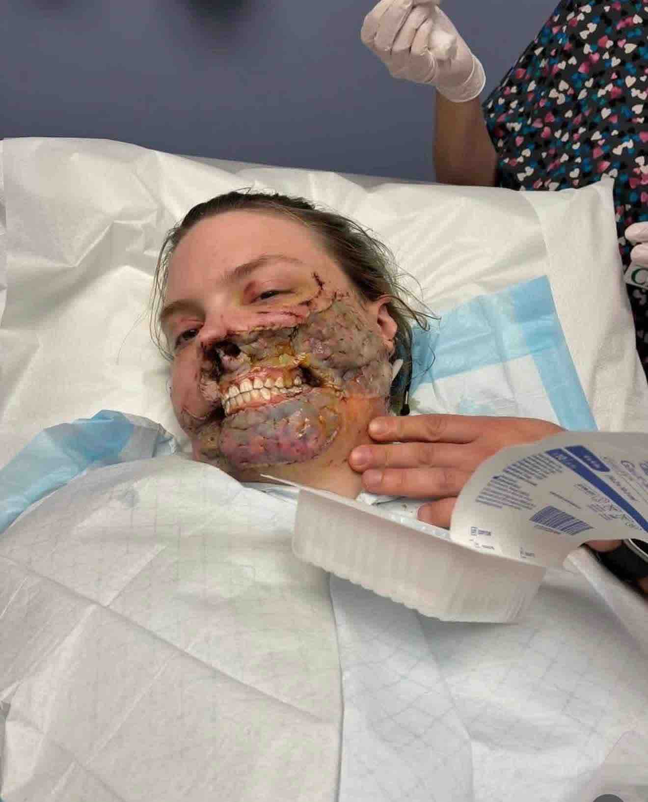 Help with nose transplant surgery campaign photo, 2 of 5
