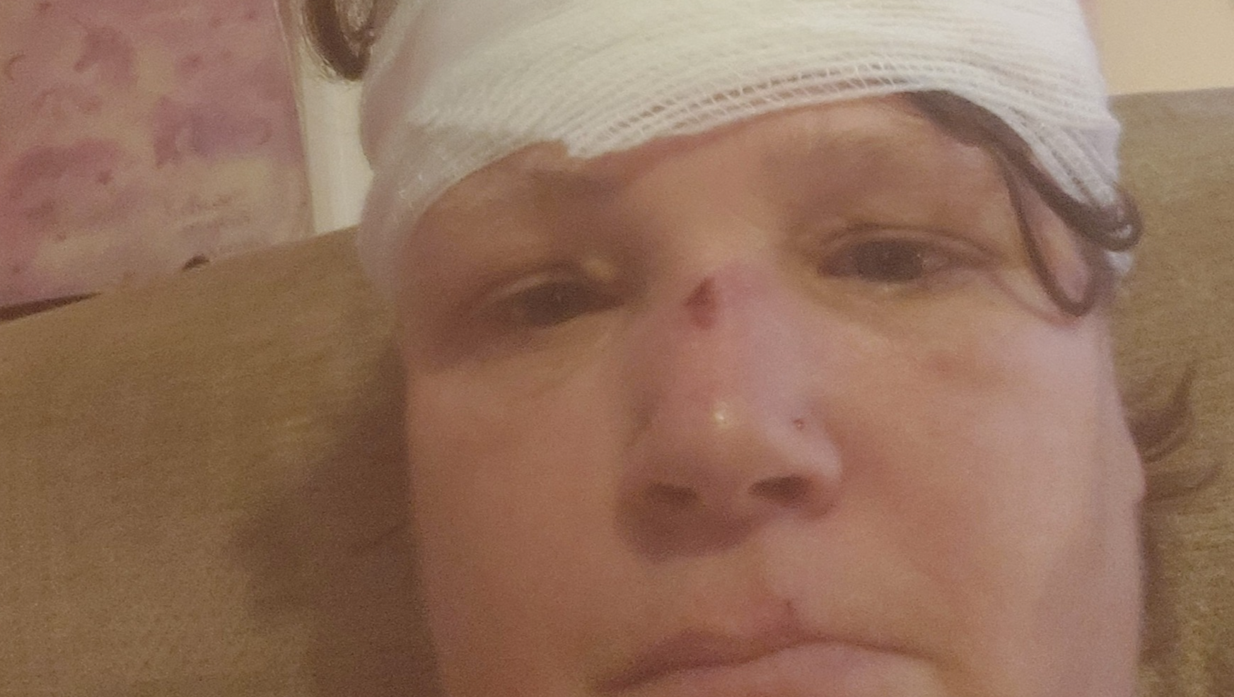 A life threatening condition epilepsy photo