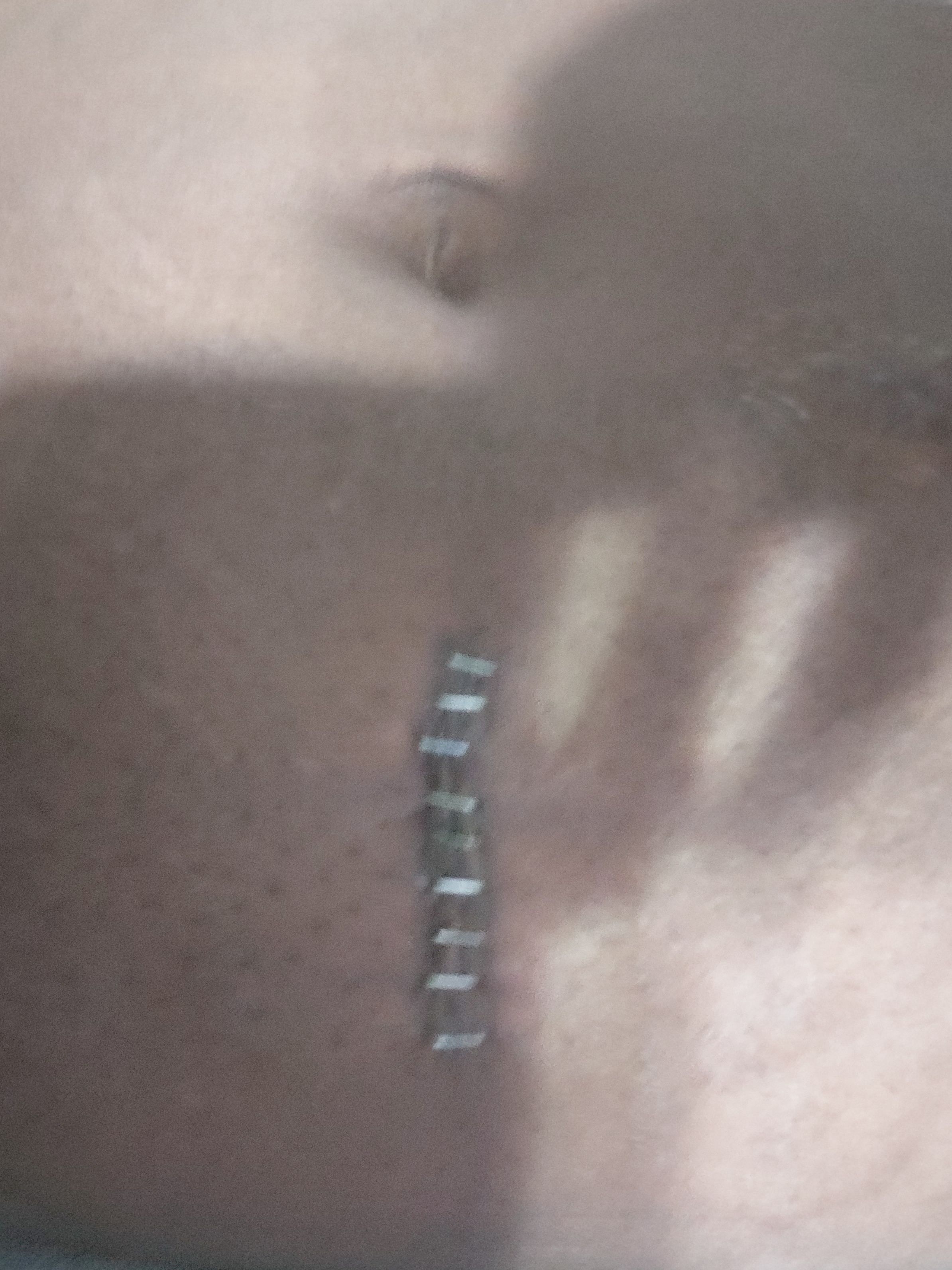 Support TeeDee Through Medical Recovery campaign photo, 2 of 4