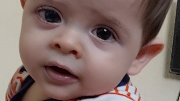 Pedimos ayuda para salvar el ojo de Samuel A. de 9 meses  photo