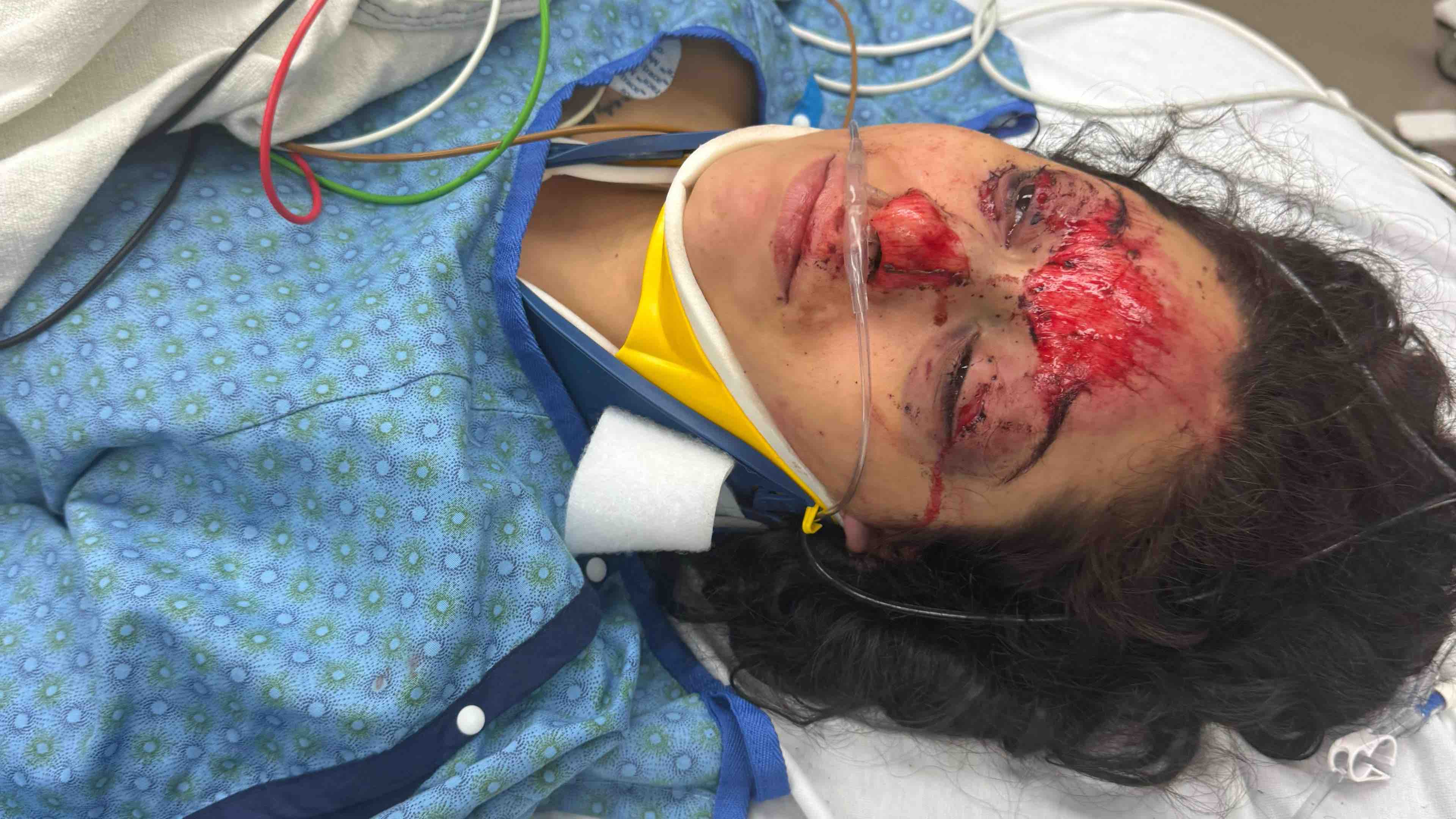 Support Jala's Recovery After Tragic Accident photo