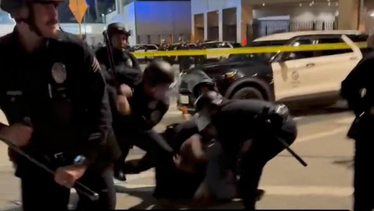 Standing with I.P. after LAPD Broke His Leg photo