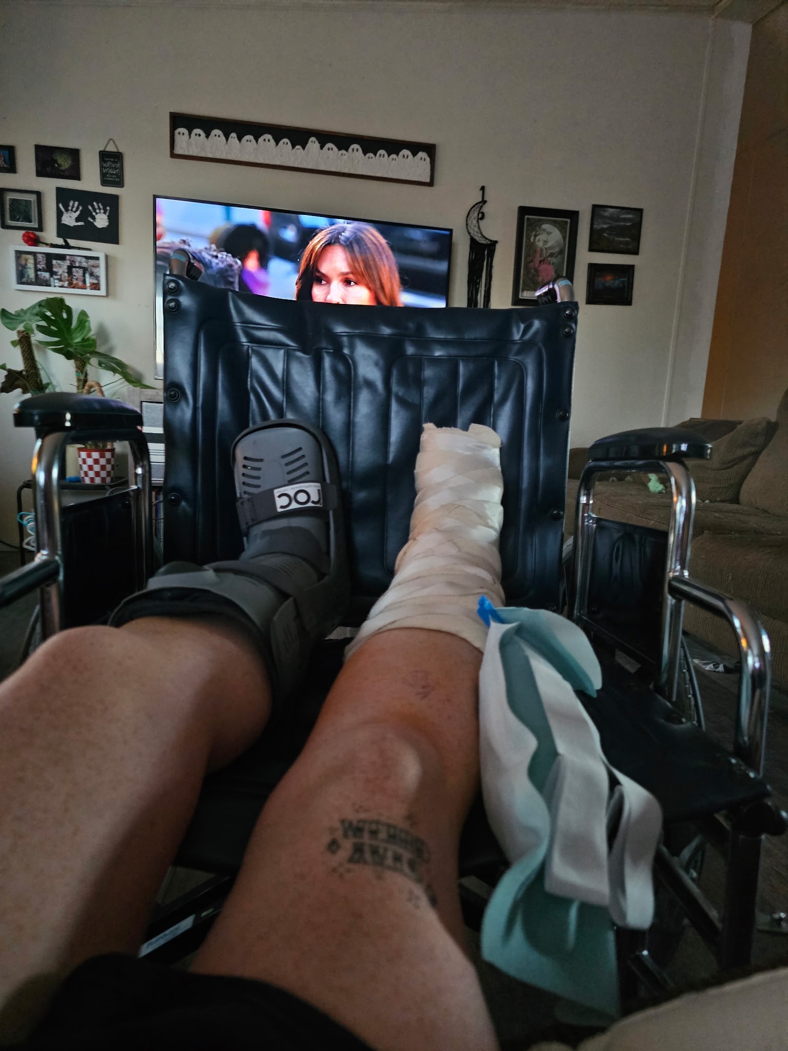 Support Amber’s Recovery After Double Leg Surgery campaign photo, 2 of 5