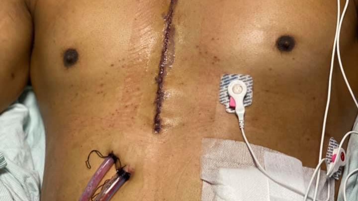 Support Cliff's Fight for a New Heart photo