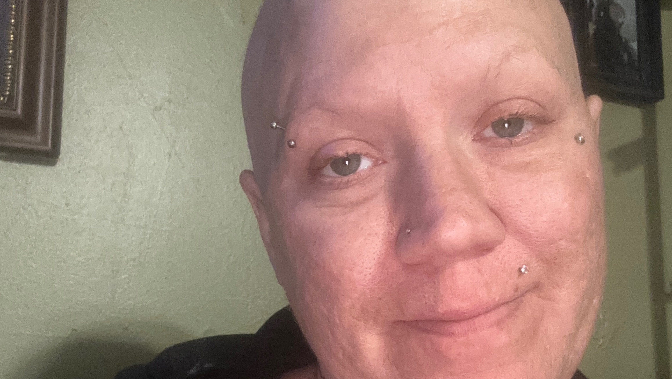 Support Lillian’s Fight Against Breast Cancer photo