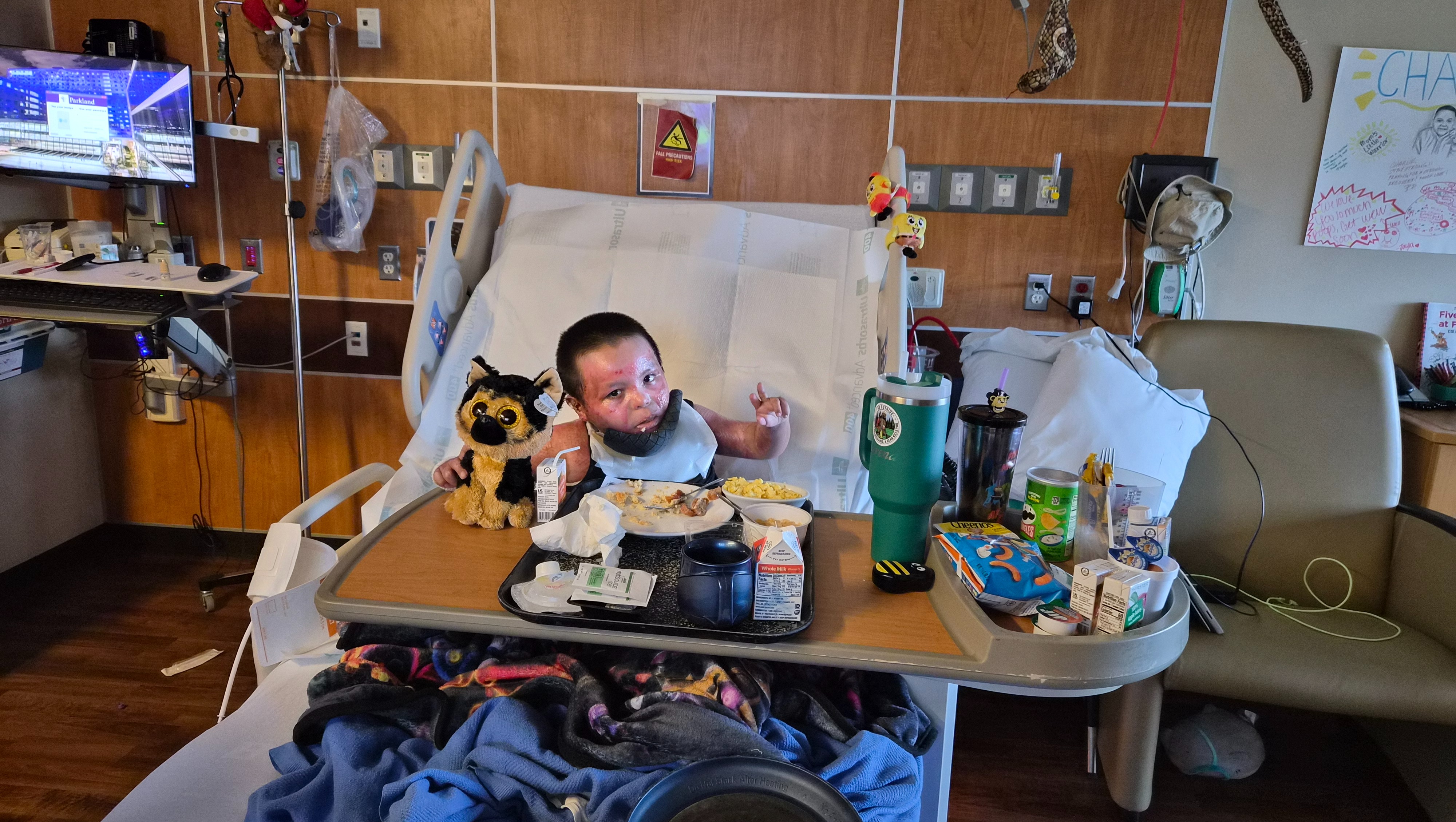 Help Charlie Heal After Burn Accident