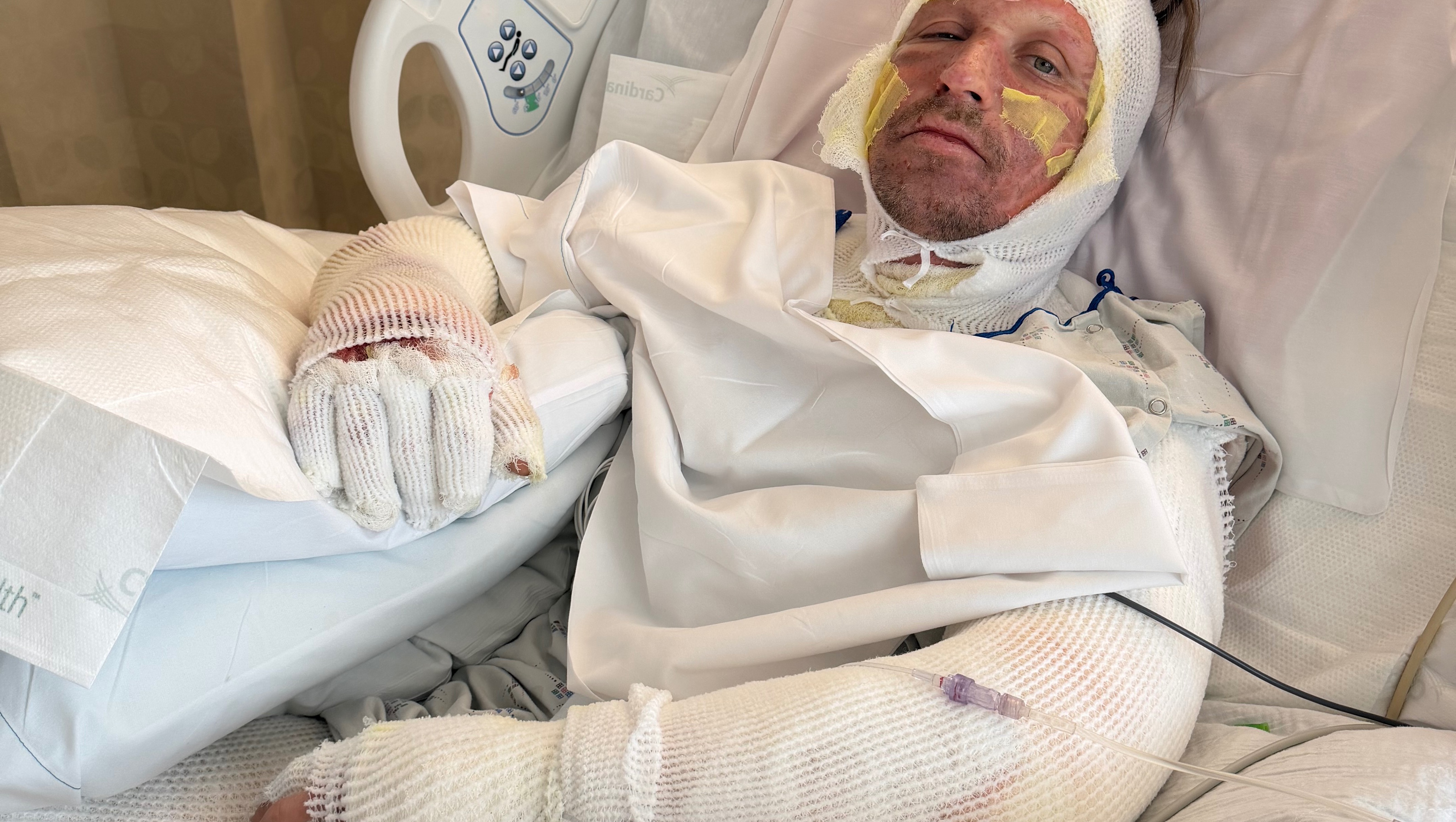 Support Igor During His Severe Burn Recovery photo