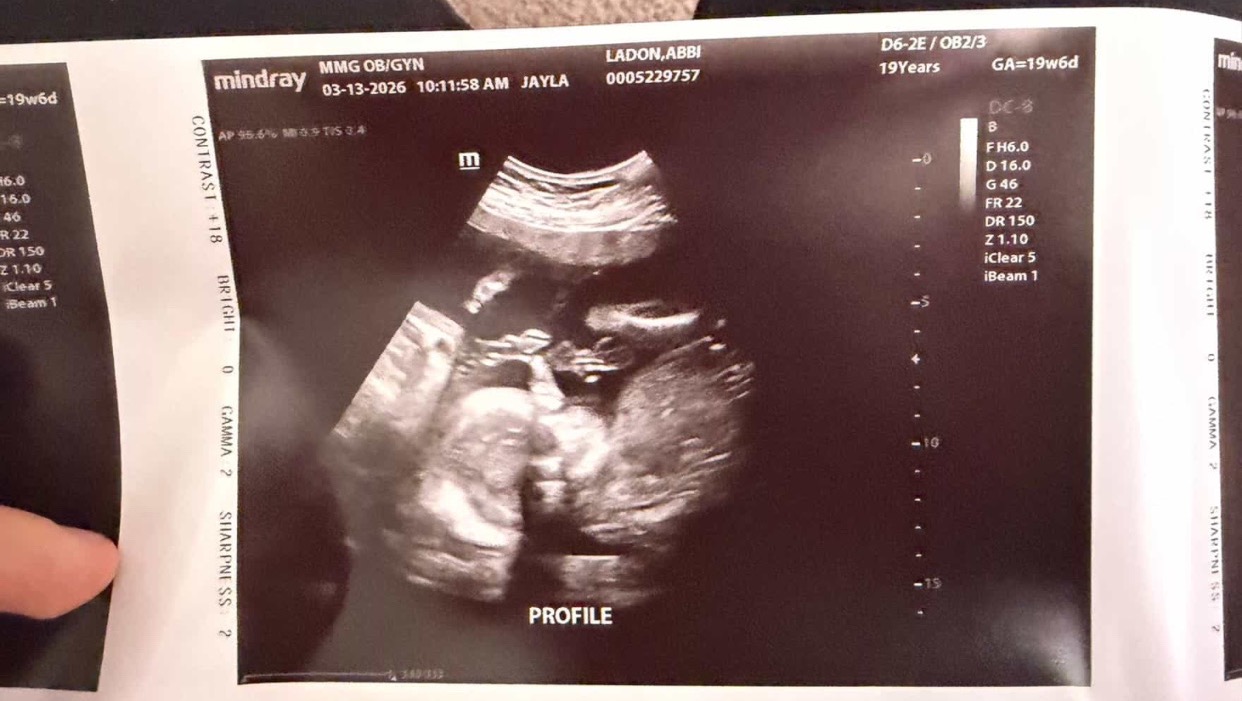 Help Abbi and Her Baby Stay Safe and Housed photo