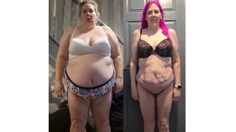 From Weight Loss to Wellbeing — A Mum’s Final Step photo