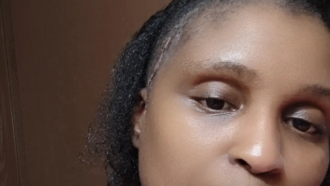 Support Yashica’s Recovery & Rehab Journey photo
