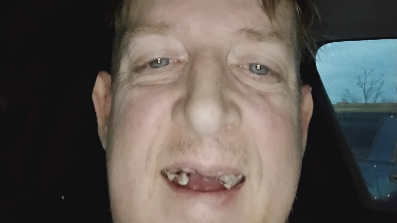 Help michael Smile Again photo