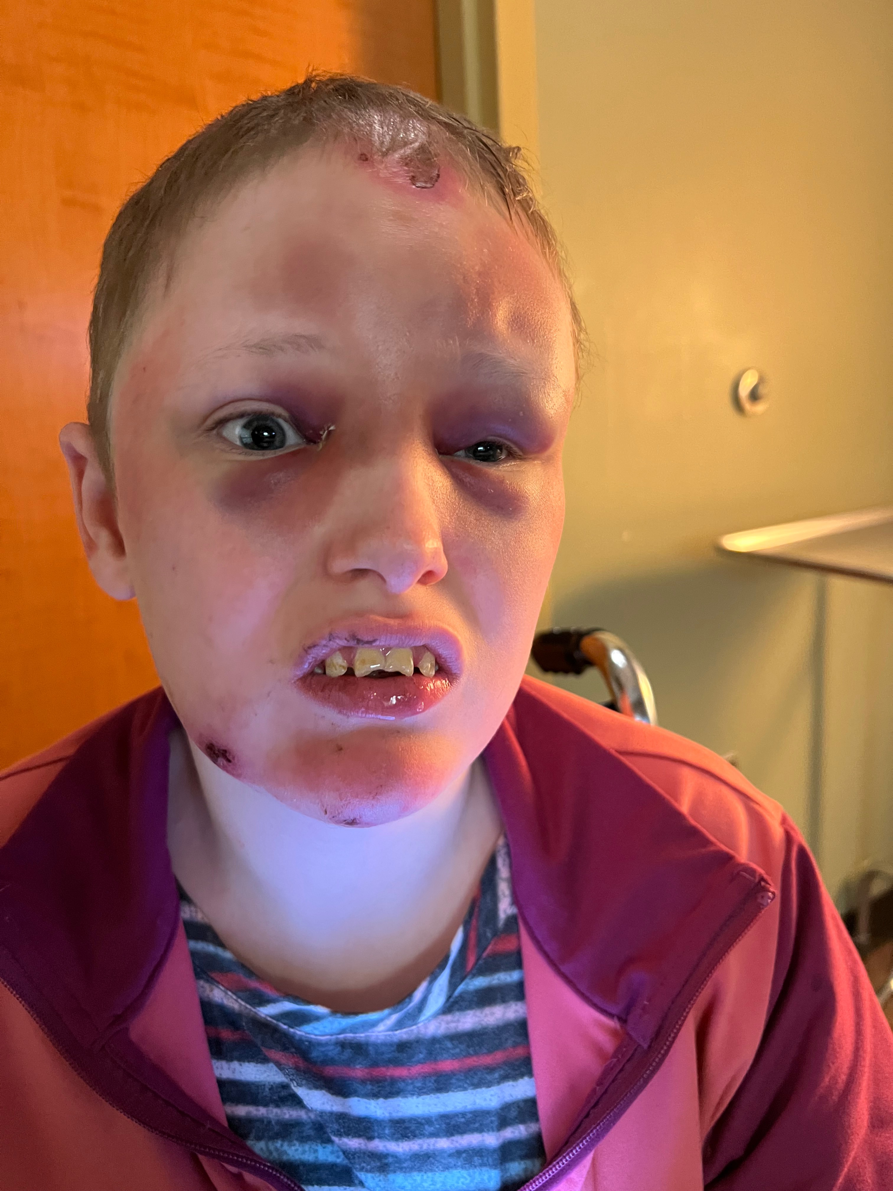 Help My Daughter Get Critical Autism Care campaign photo, 6 of 8