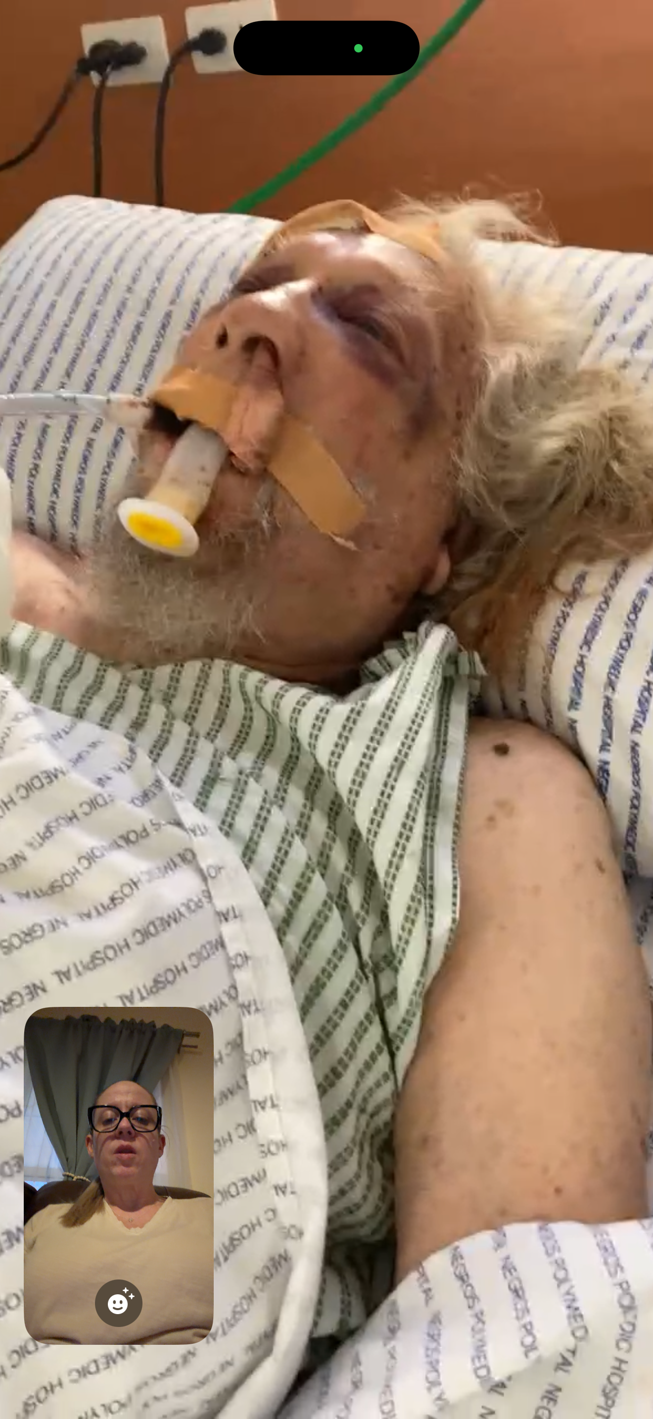 Support Uncle Hanky's Surgery and Recovery campaign photo, 2 of 8