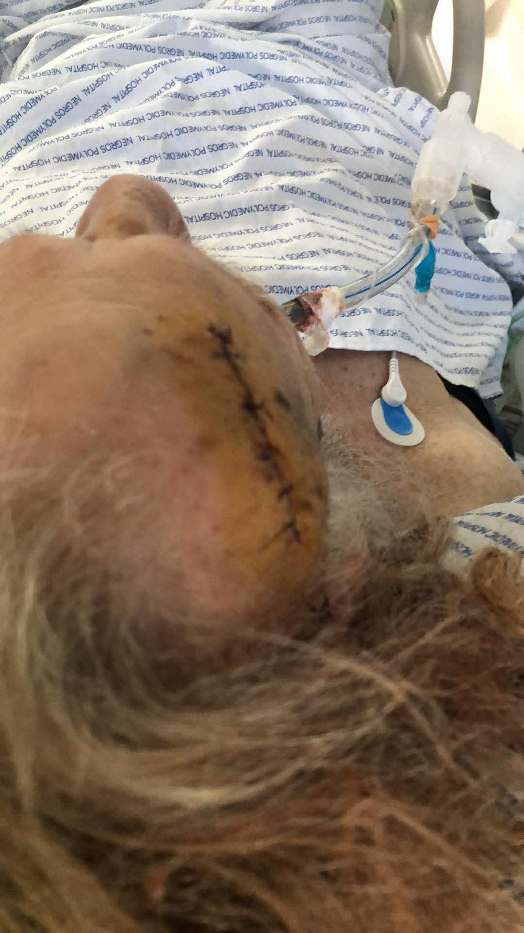 Support Uncle Hanky's Surgery and Recovery campaign photo, 5 of 8