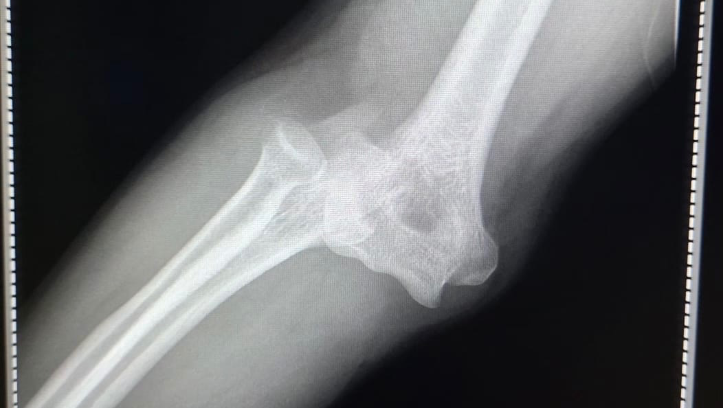 Ayúdame a pagar mi cuenta médica por favor photo