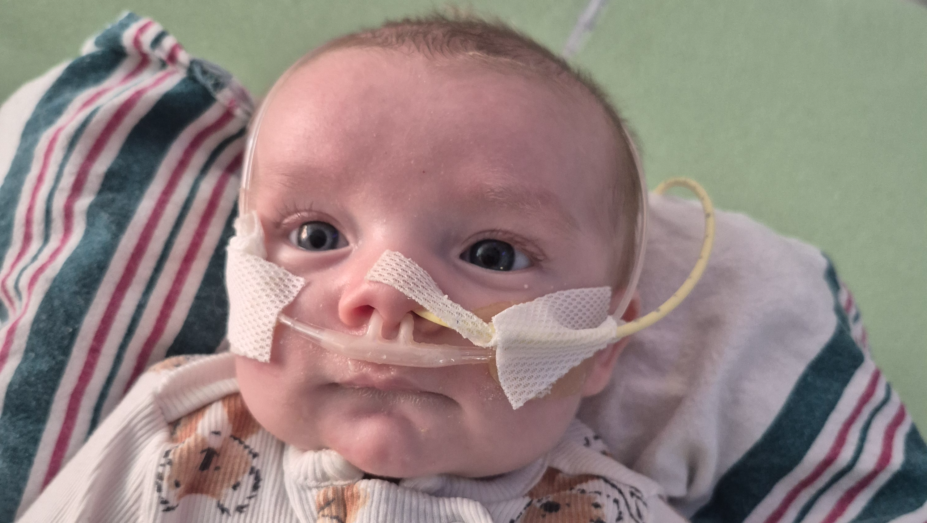 Support for Baby's Heart Surgery and Care photo