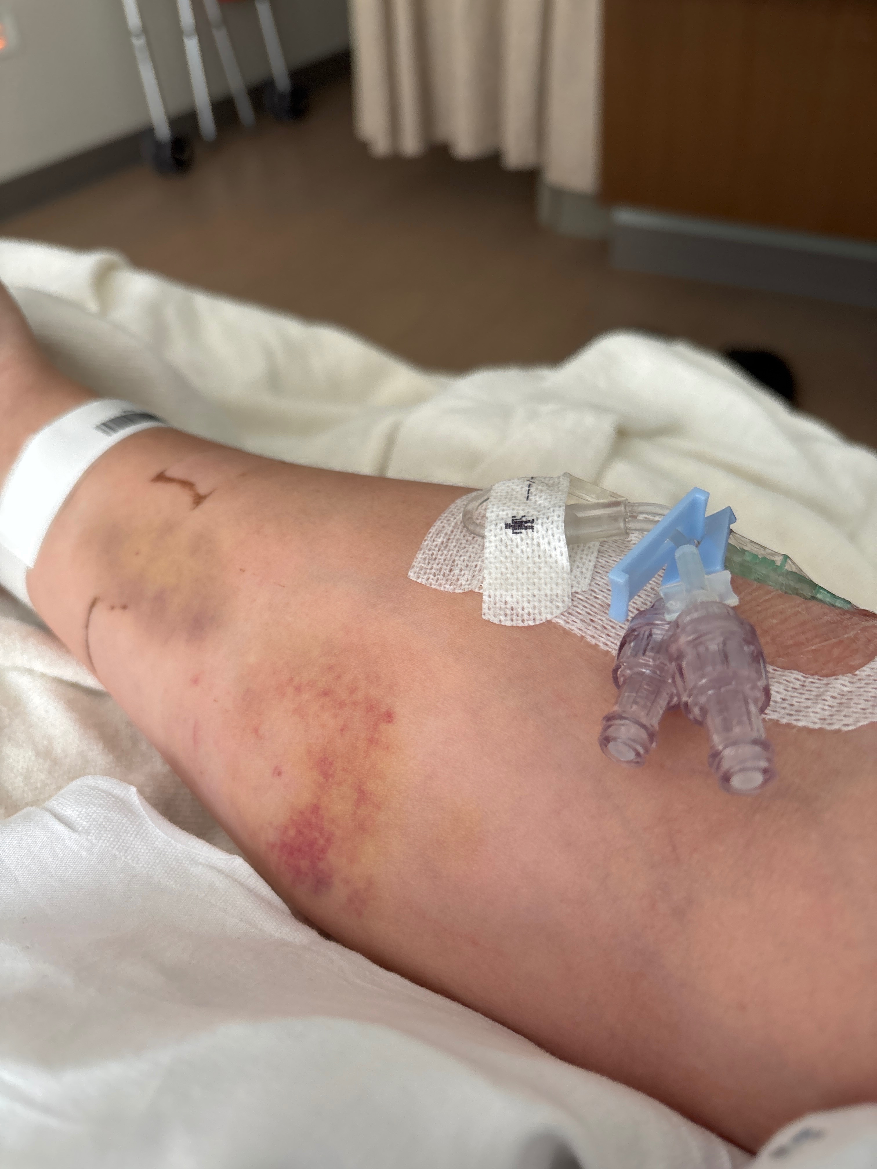 Fund Grayson's Medical Treatment and PT campaign photo, 2 of 5