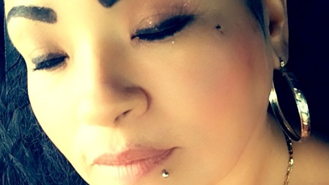 Support Angela's Glaucoma Recovery Journey photo