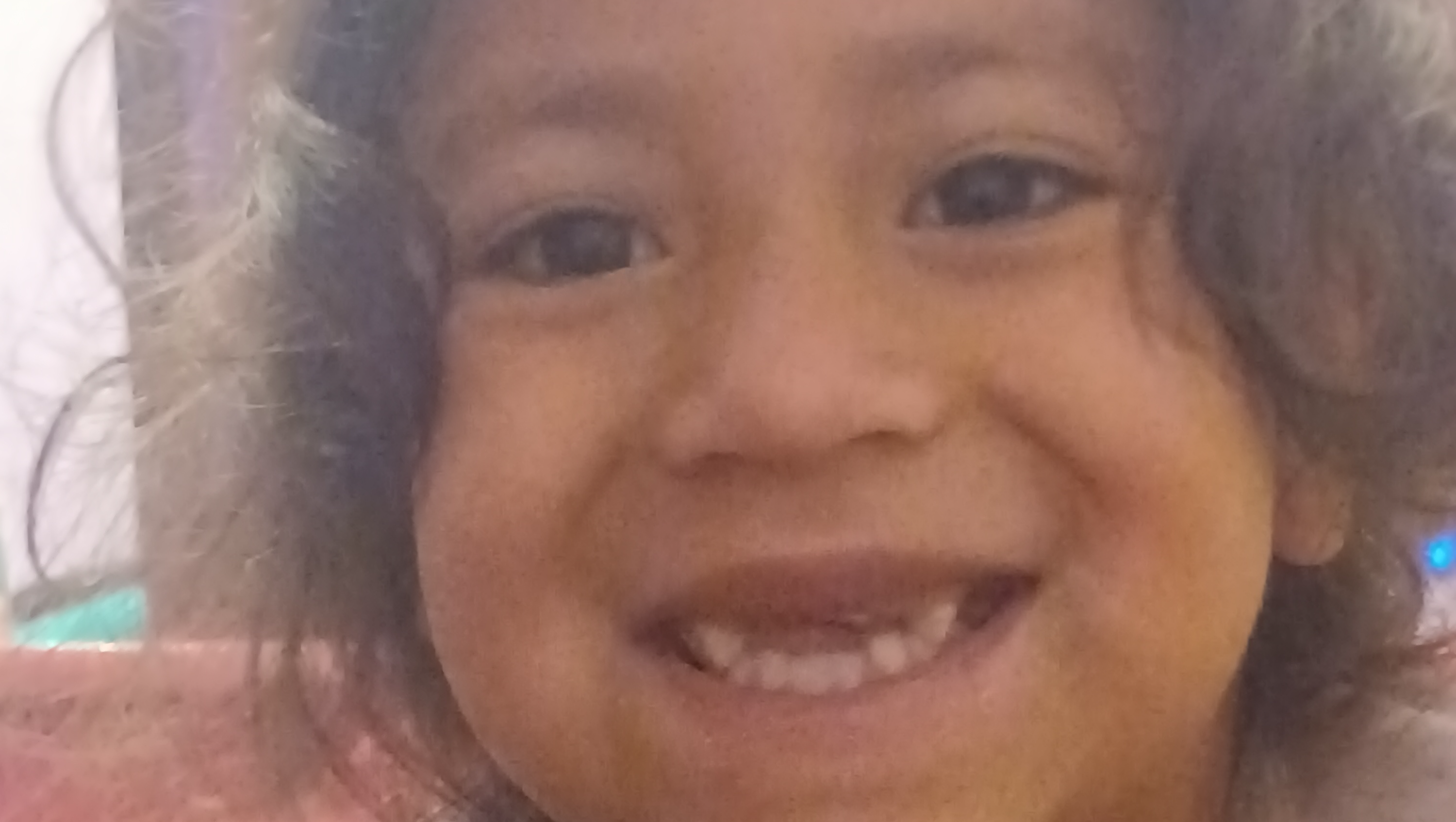 recuperar la sonrisa de Génesis  photo