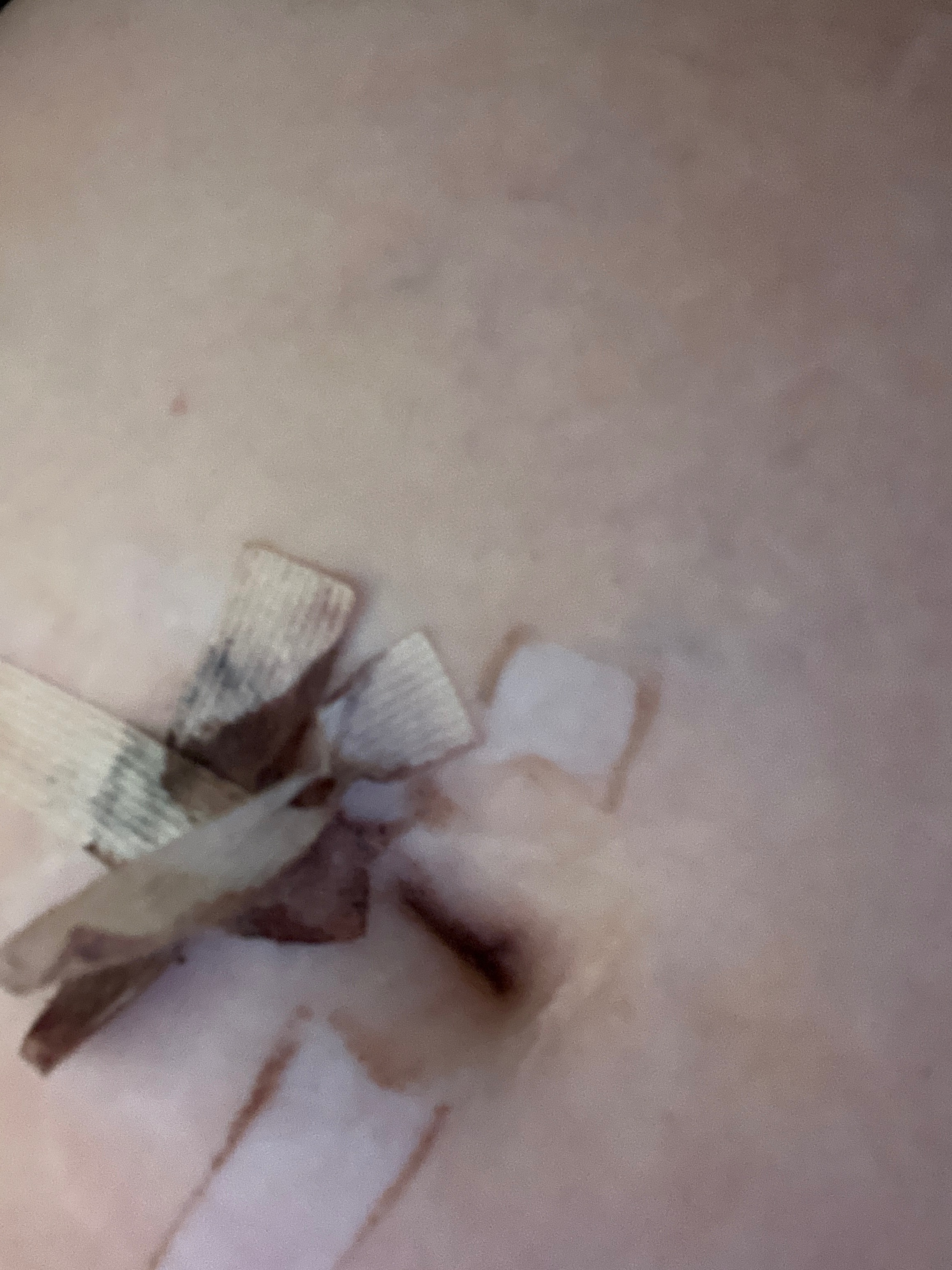 Support Jamie’s Endometriosis Recovery campaign photo, 5 of 6
