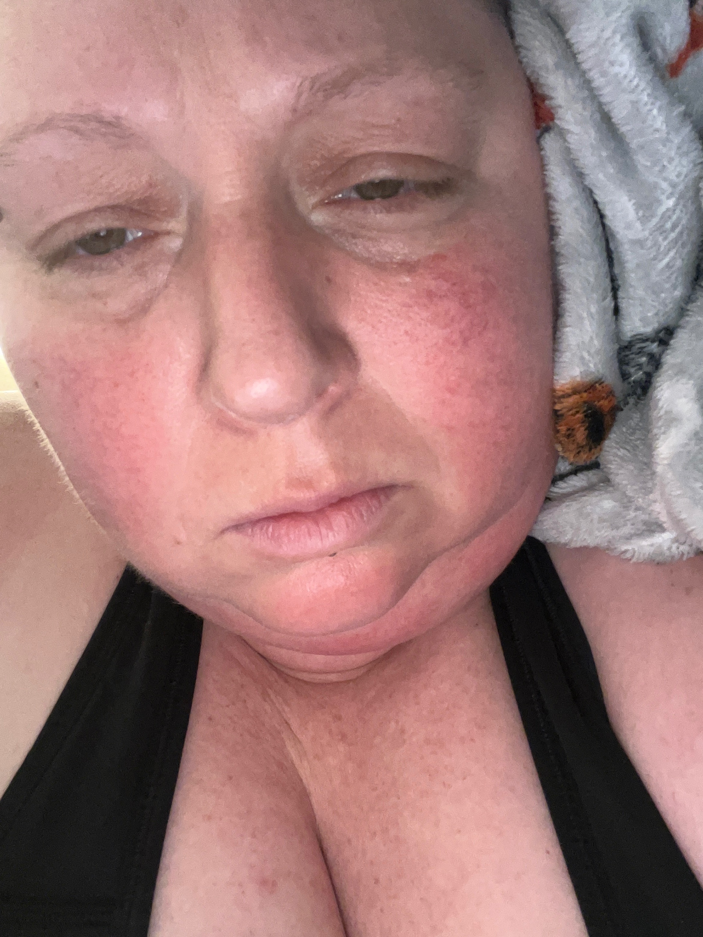 Support Jamie’s Endometriosis Recovery campaign photo, 4 of 6