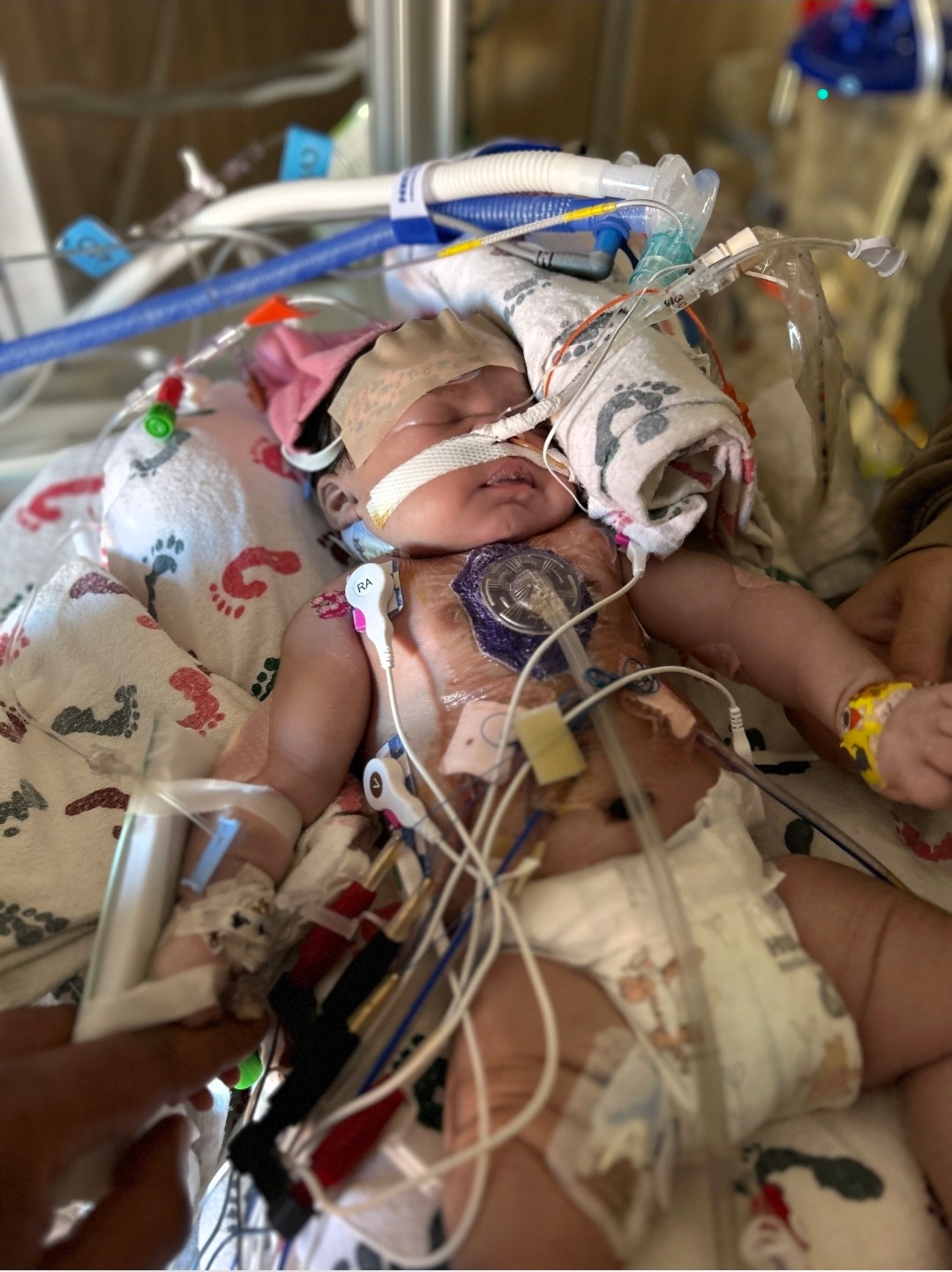 Her Fight Is Over, Her Love Lives On: Helping Lay Baby Seren campaign photo, 4 of 7
