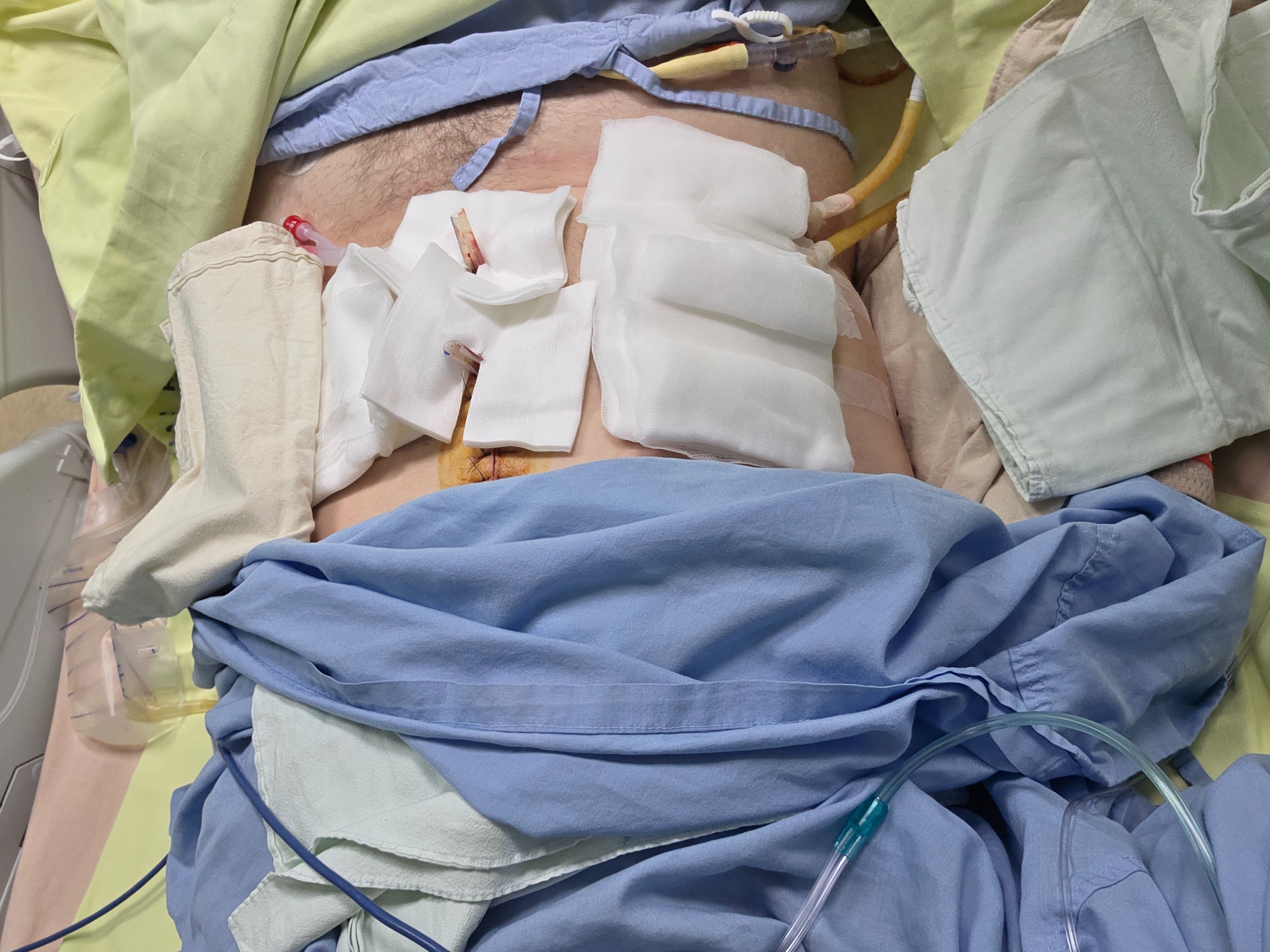 Oma and I Almost Died - Emergency Surgery & Recovery Help campaign photo, 6 of 8