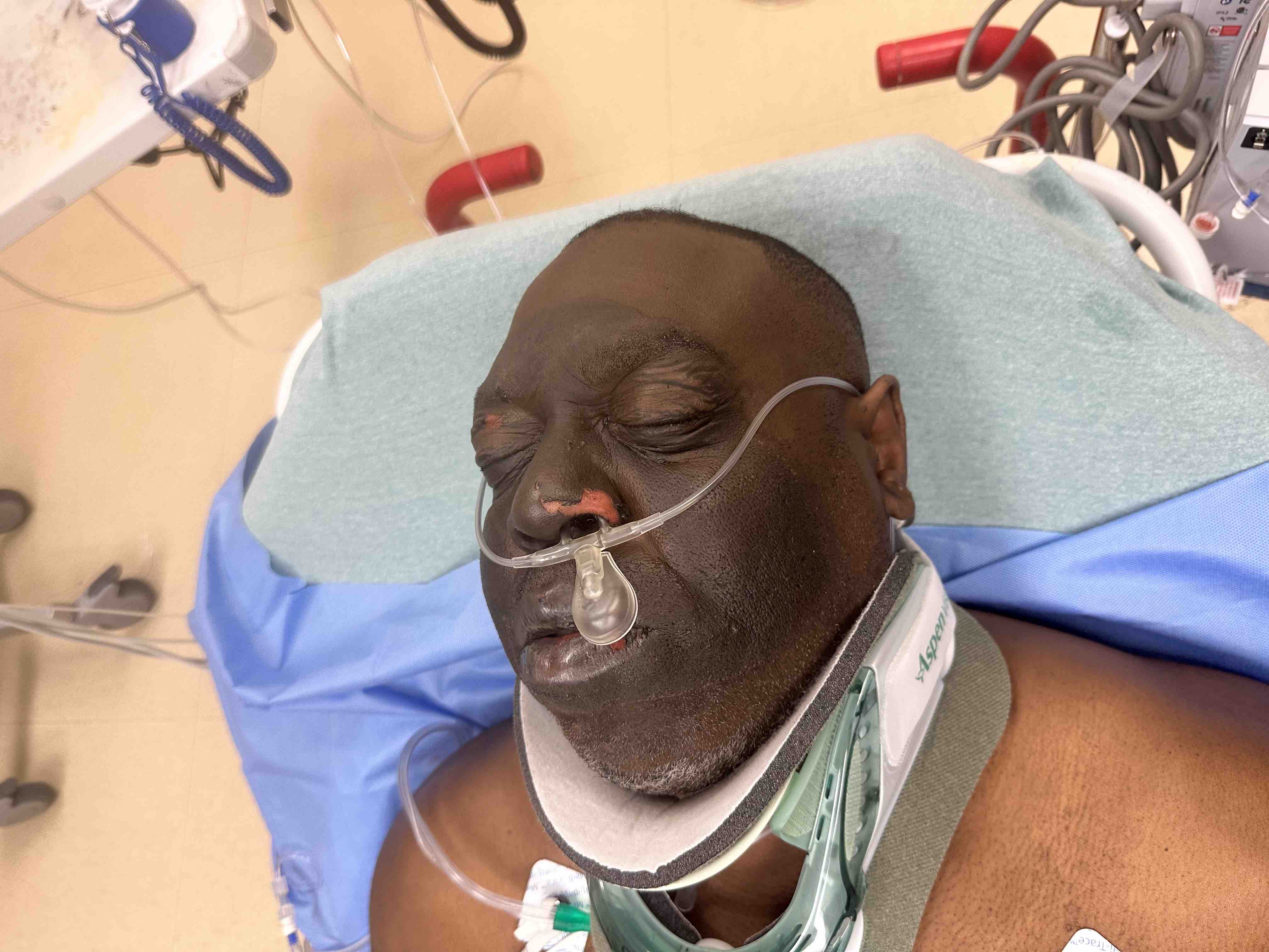Help Burn Victim Edward Coleman Recover campaign photo, 6 of 8