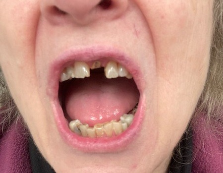 Help Restore Connie’s Health and Her Smile campaign photo, 4 of 6