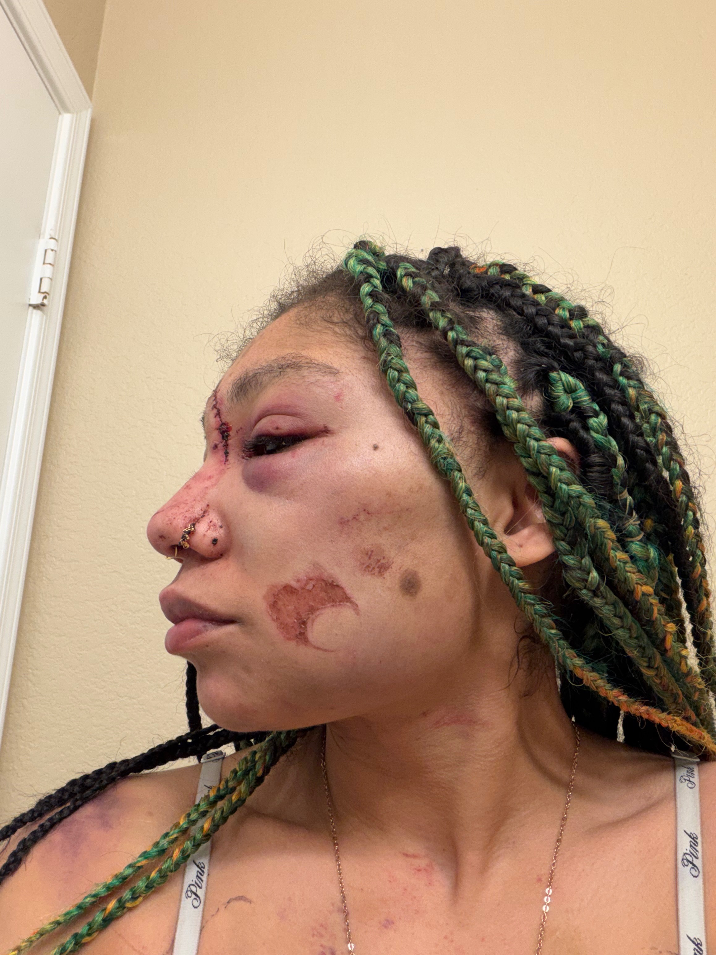 Survivor trying to survive campaign photo, 5 of 8