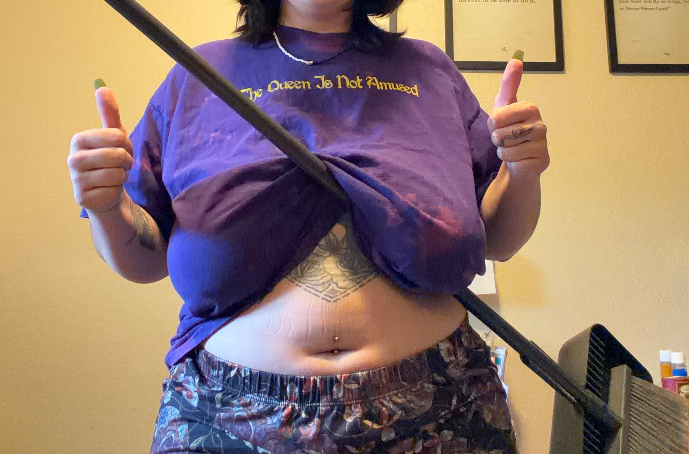 Help Me Finally Get My Breast Reduction Surgery campaign photo, 4 of 7