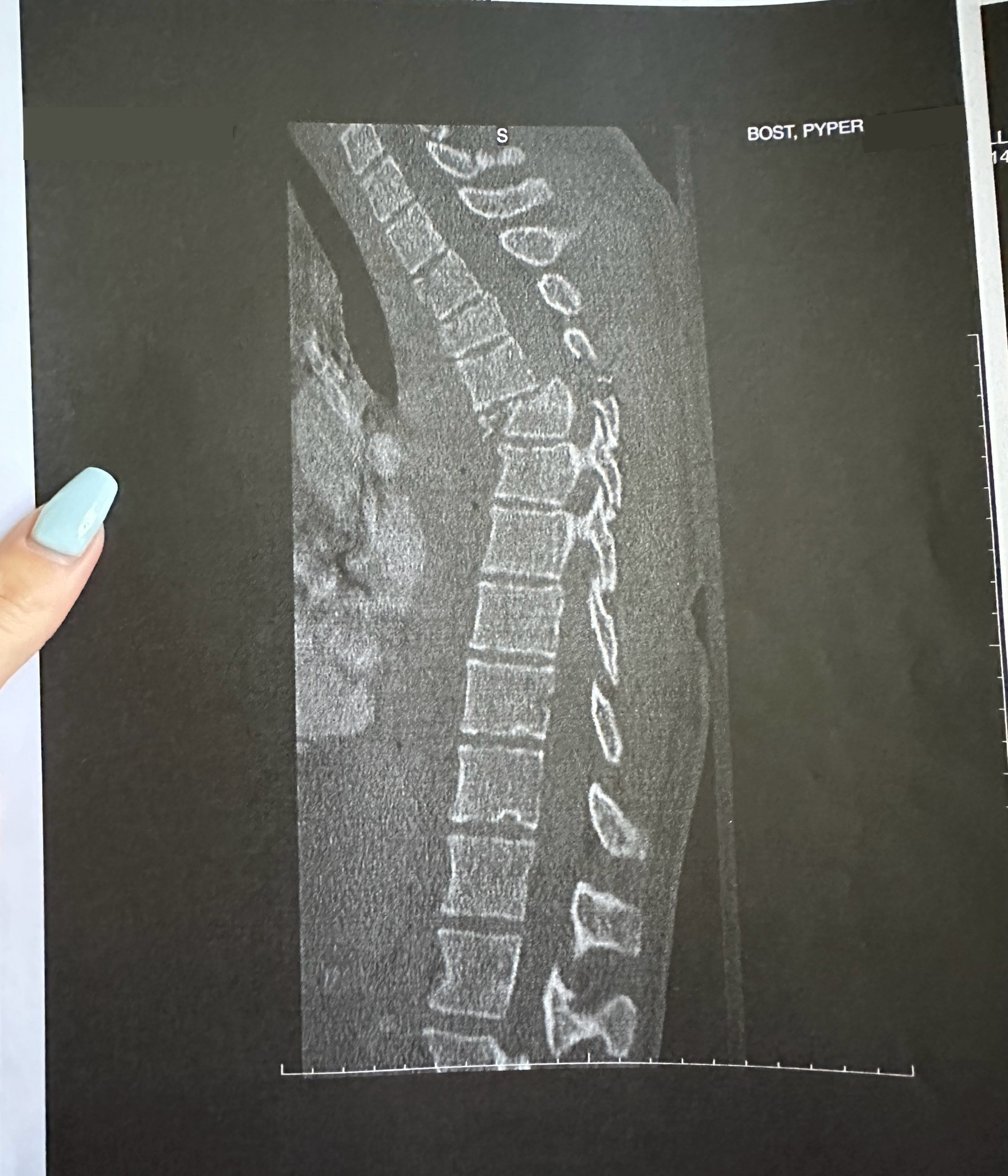 Fundraiser by Pyper Bost : Help Pyper Walk Again with Barwis
