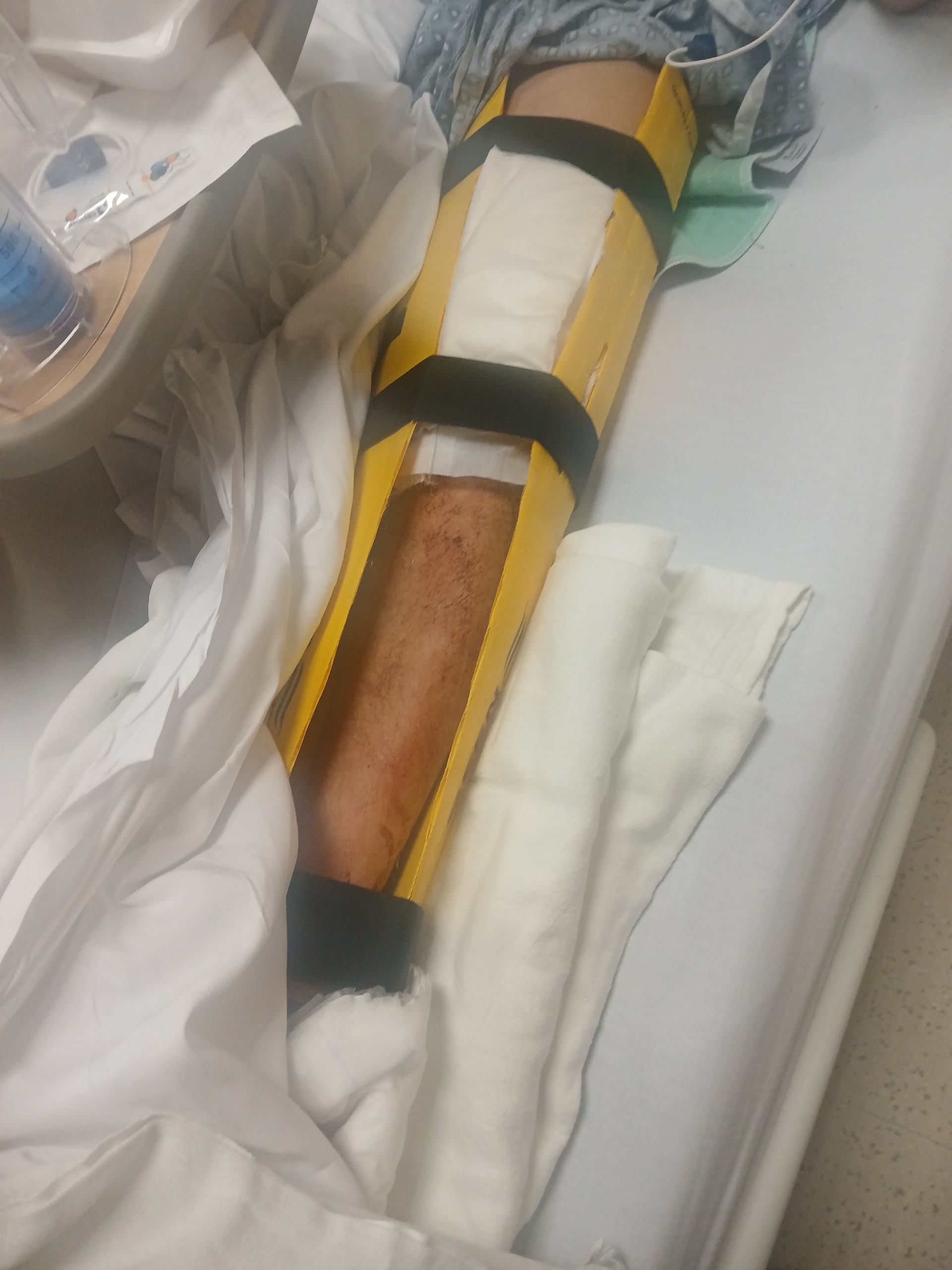 Spring Break Recovery Kit Fundraiser by Mary Perlstein : Support for My Son’s Recovery After ...