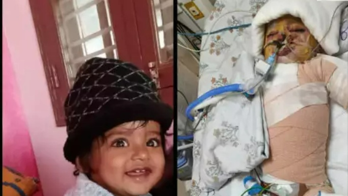 Fundraiser by Sushma Reddy : Help Save 17-Month-Old Reyansh After ...