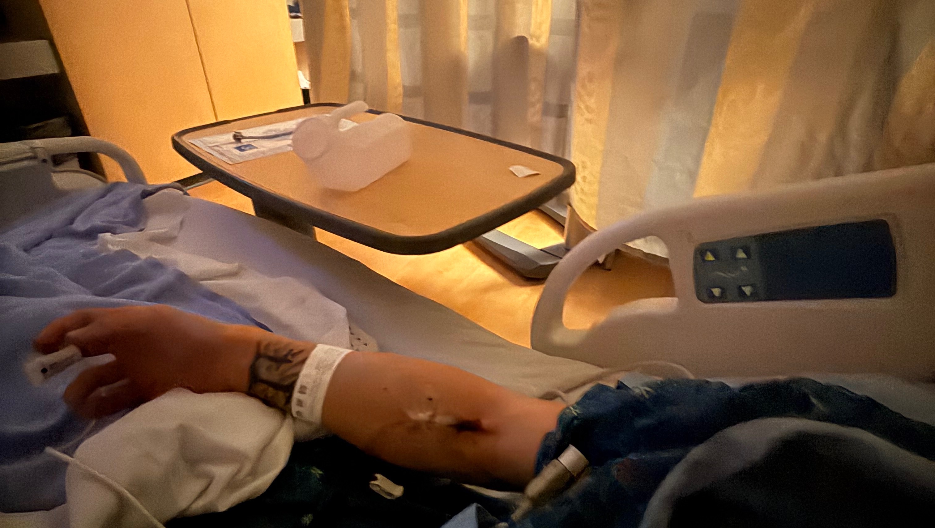 Brady's Road to Recovery After Car Accident photo