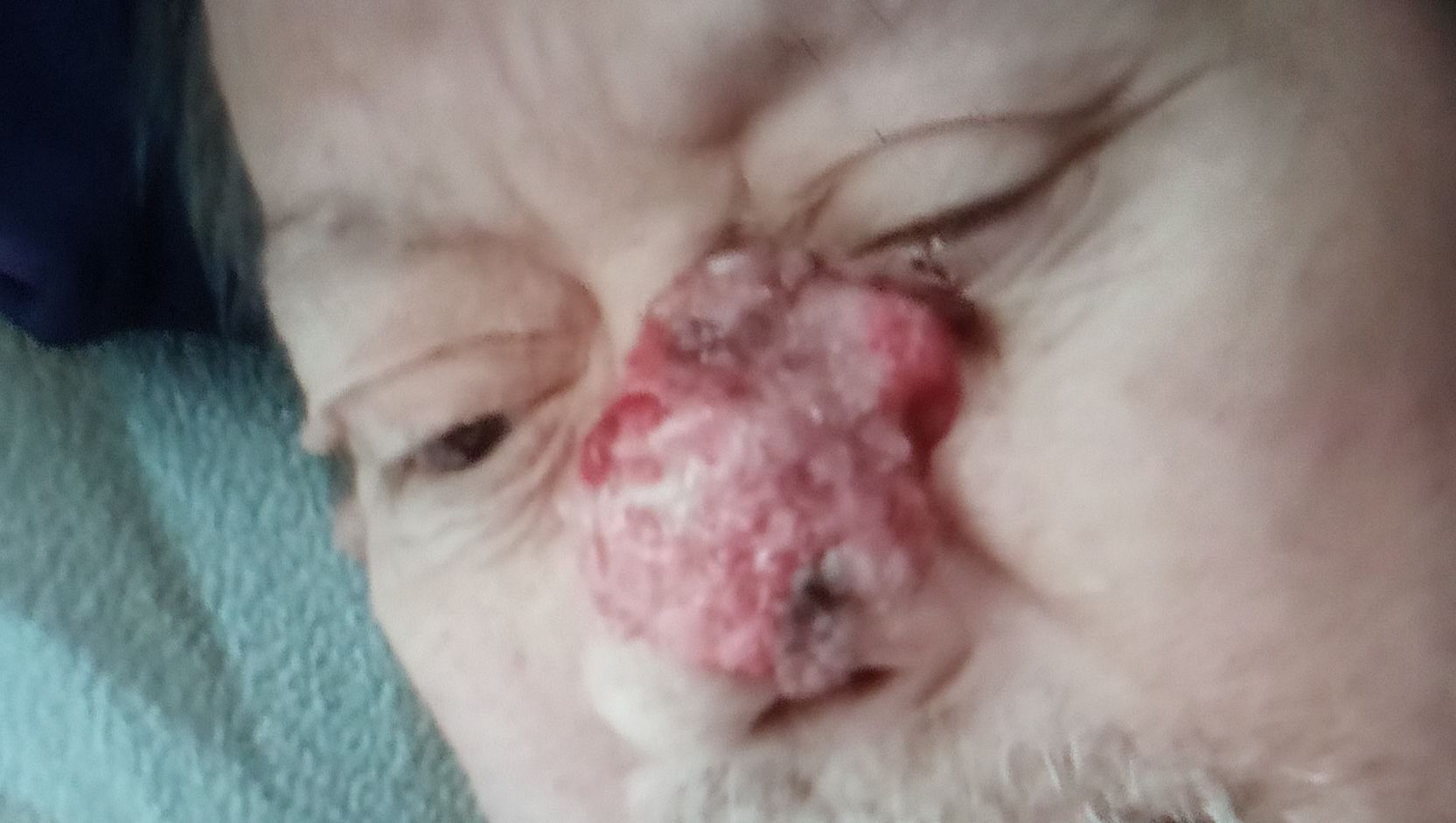 Support for my fathers bloody tumor  photo