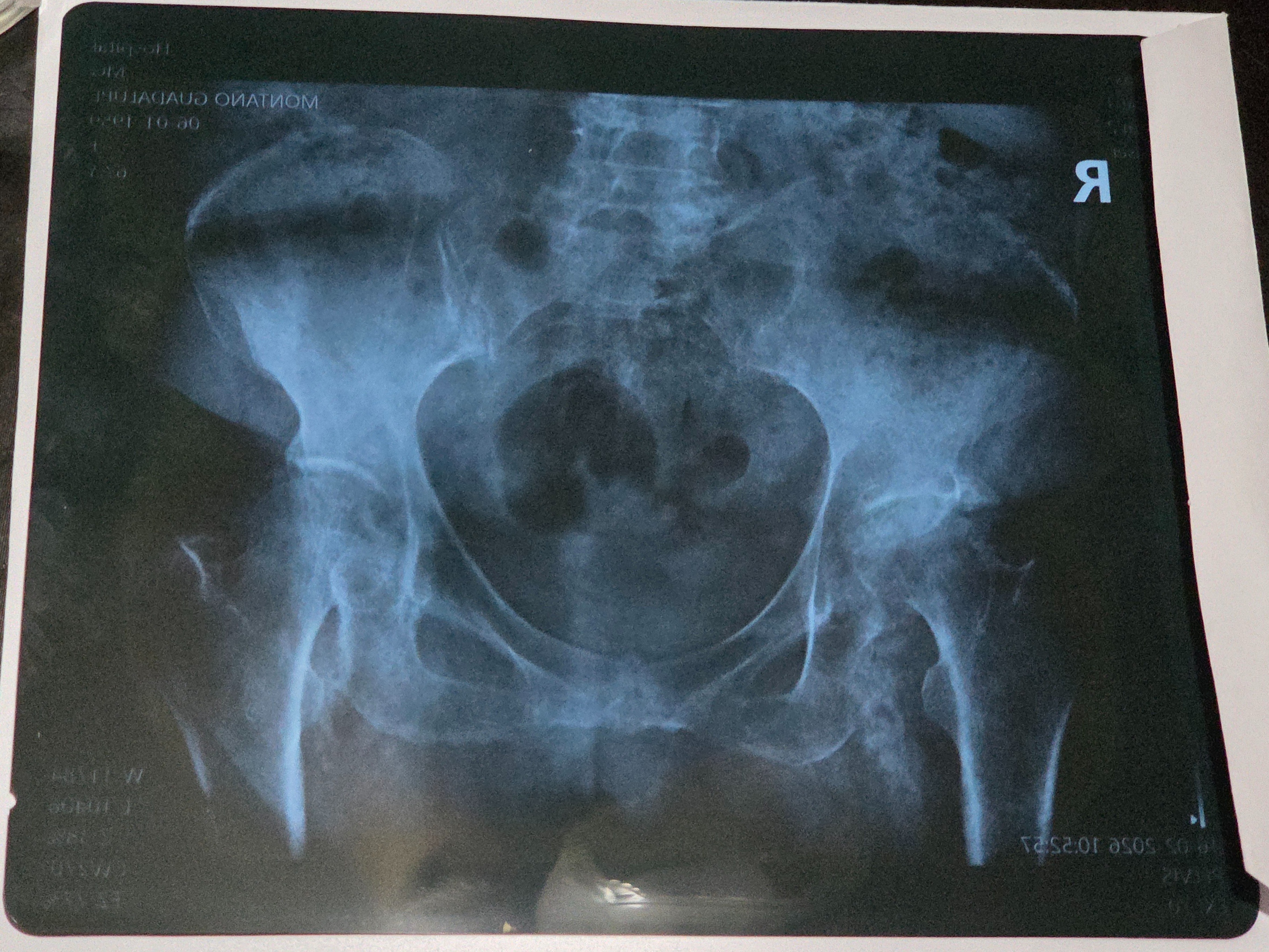 Support My Mom’s Hip Replacement Surgery campaign photo, 6 of 7