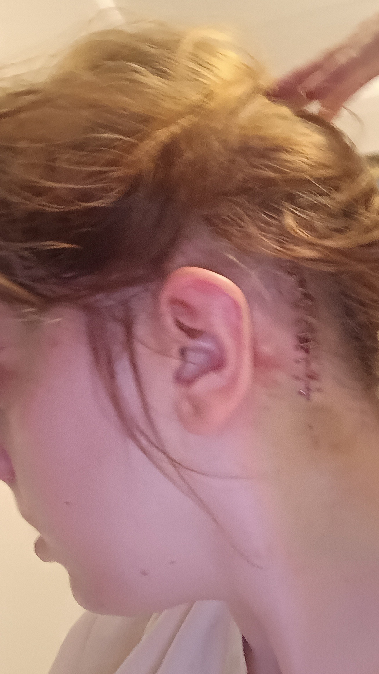 Help me recover my life: neurofibromatosis type 2& paralysis campaign photo, 5 of 7