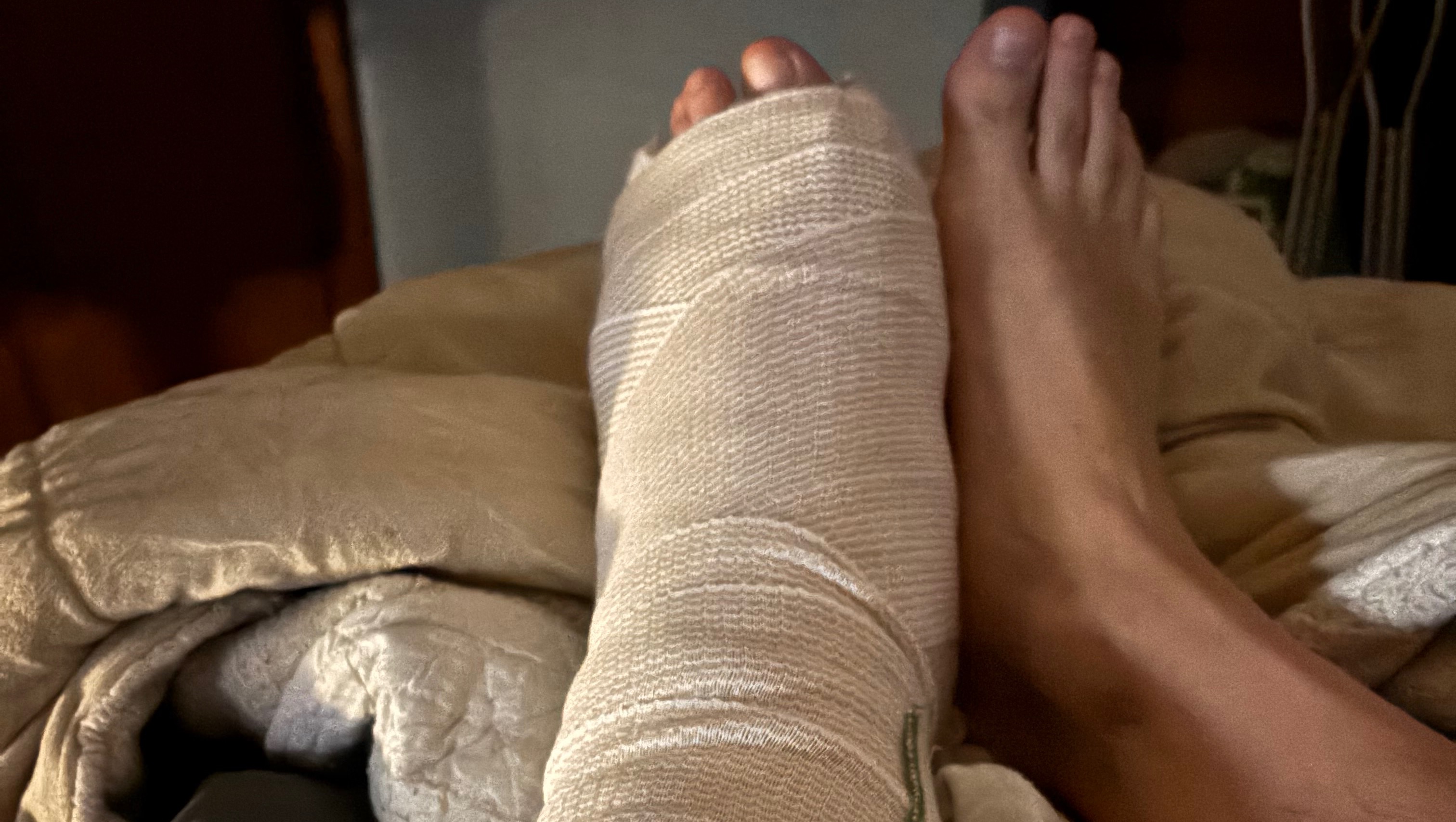 Support Anthony’s Recovery After Emergency Knee Surgery photo