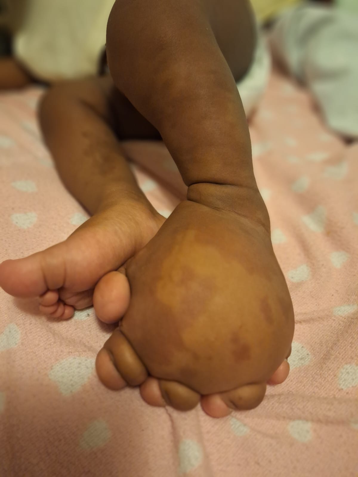 help  Elli a 7 months old baby raise fund for surgery campaign photo, 2 of 4