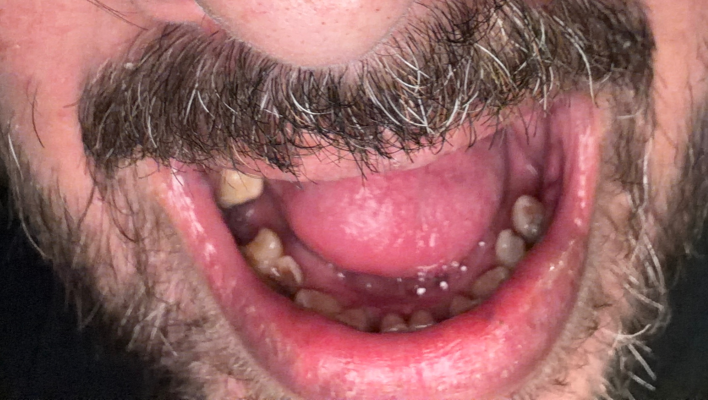 Help Me Eat Without Pain & Smile Again photo