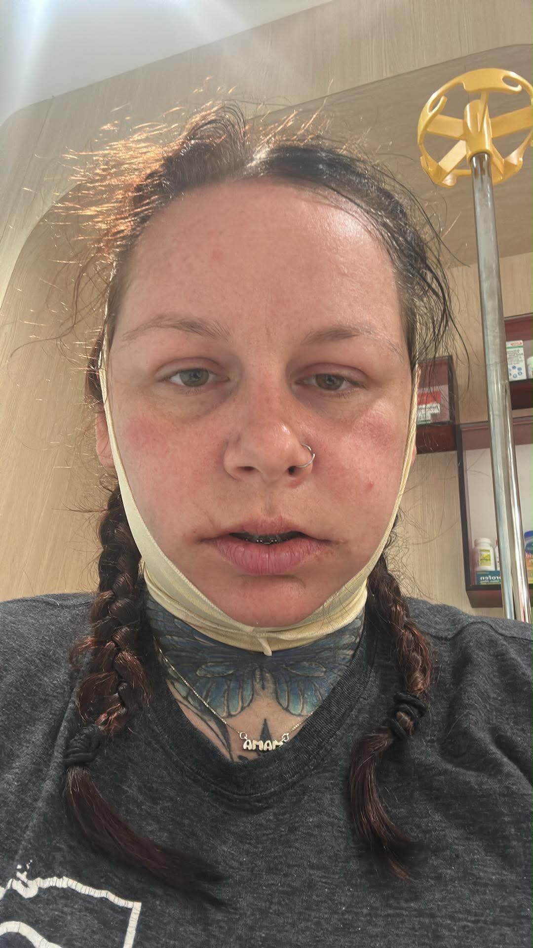 Fundraiser for Brooke Ross by Kindal Kidd : Support Brooke’s Healing ...