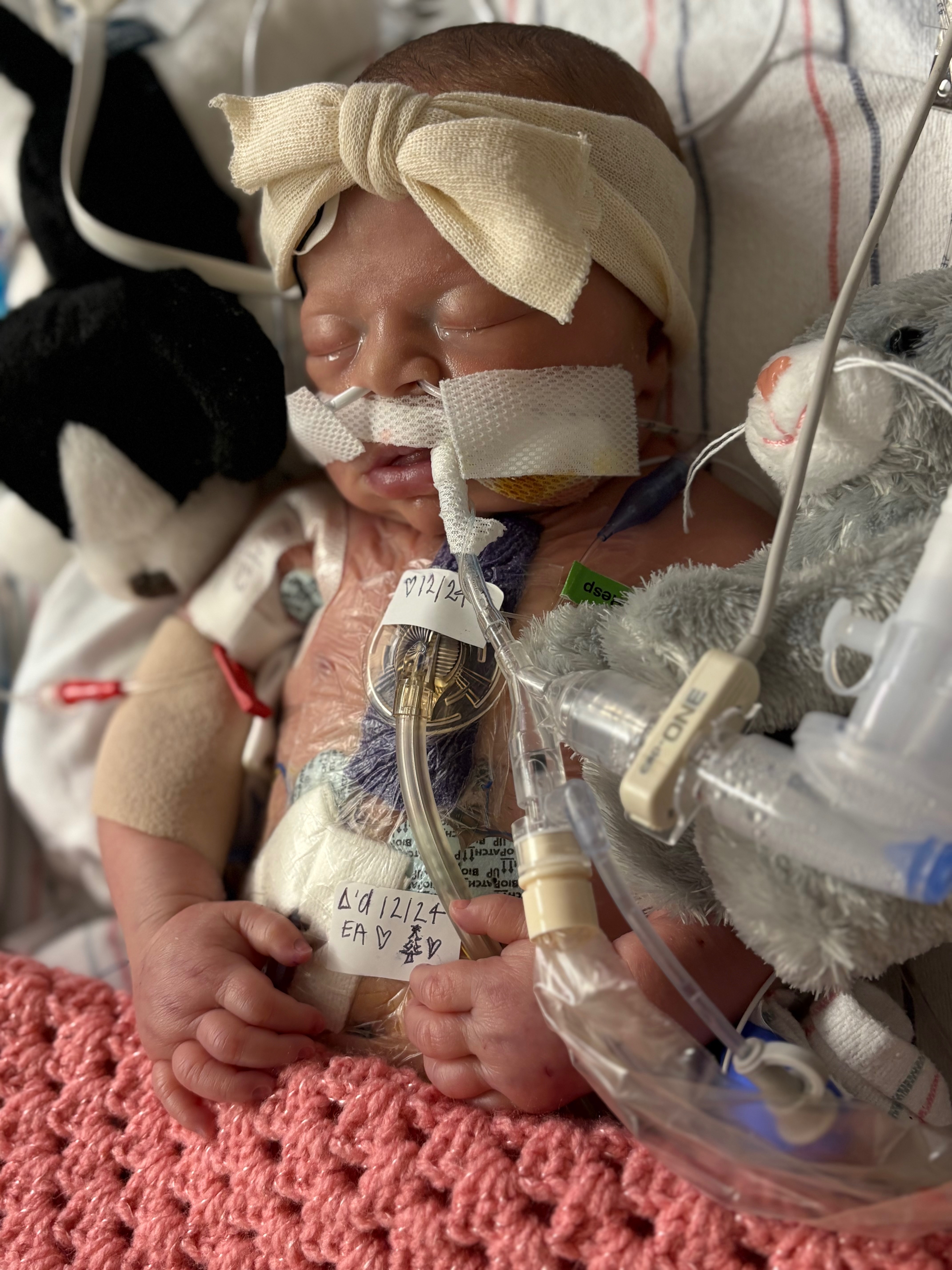 Help Us Support Olivia, Our CHD Warrior Baby campaign photo, 2 of 8