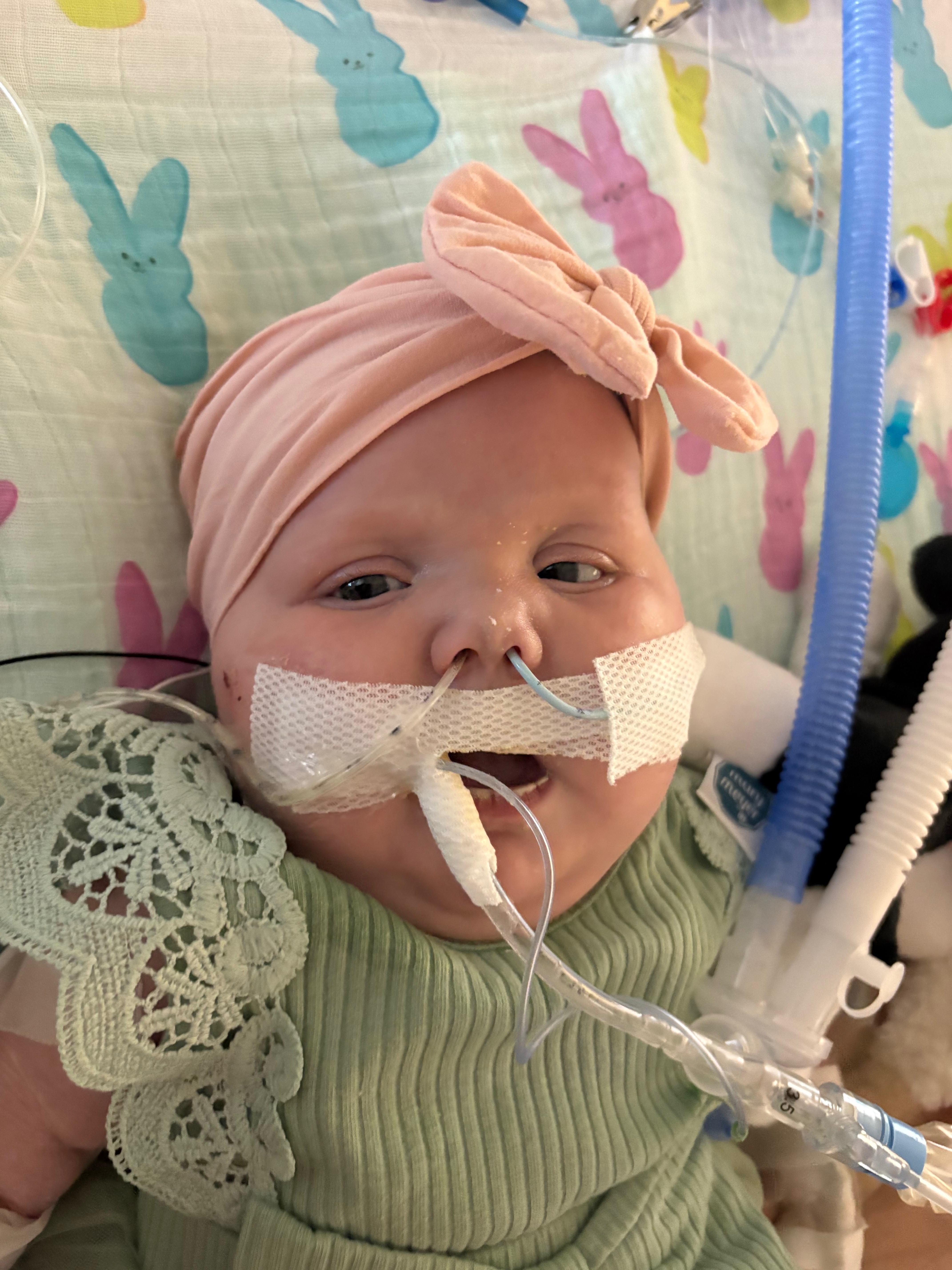 Help Us Support Olivia, Our CHD Warrior Baby campaign photo, 4 of 8